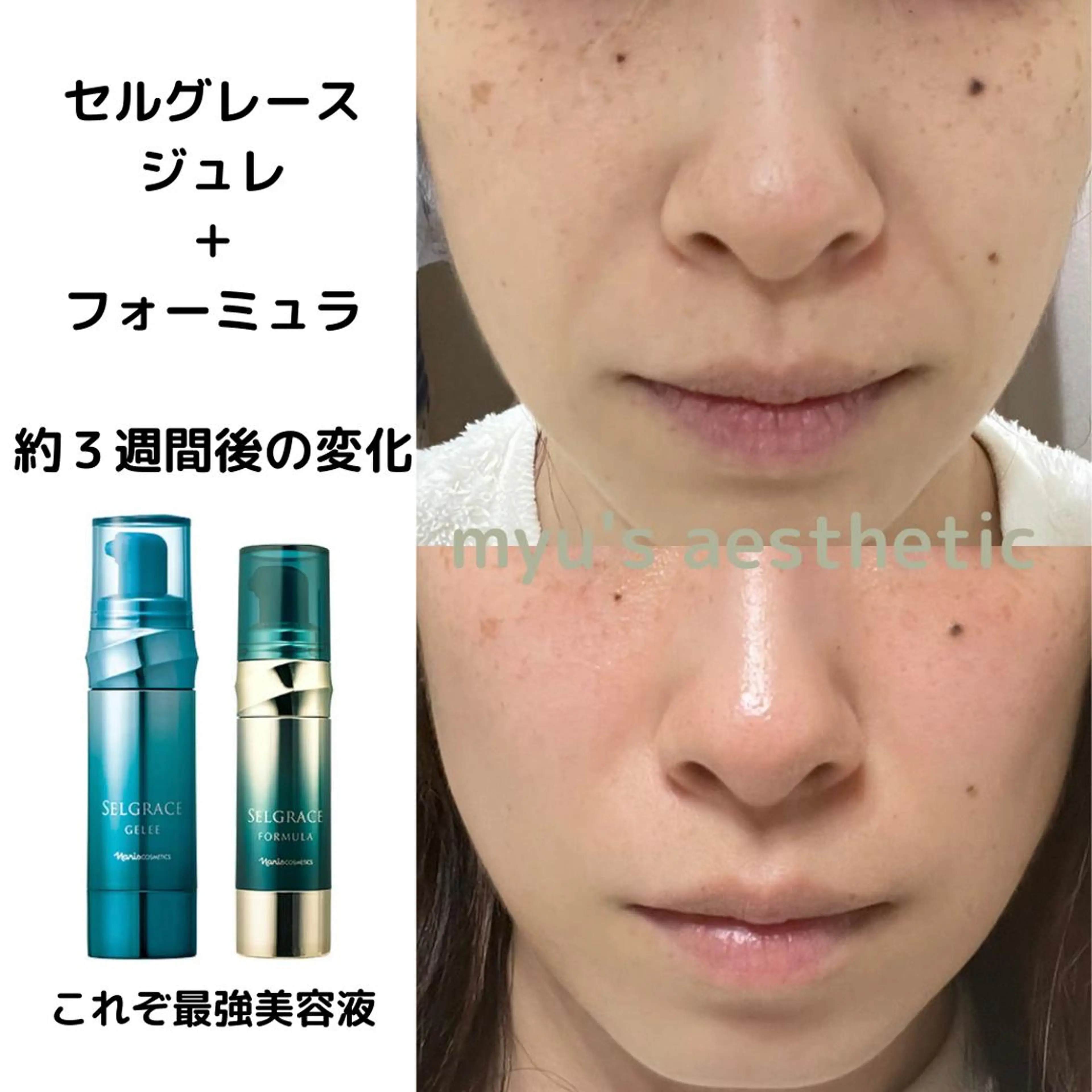 ミューズエステ 谷口美結のエステ・リラクイメージ