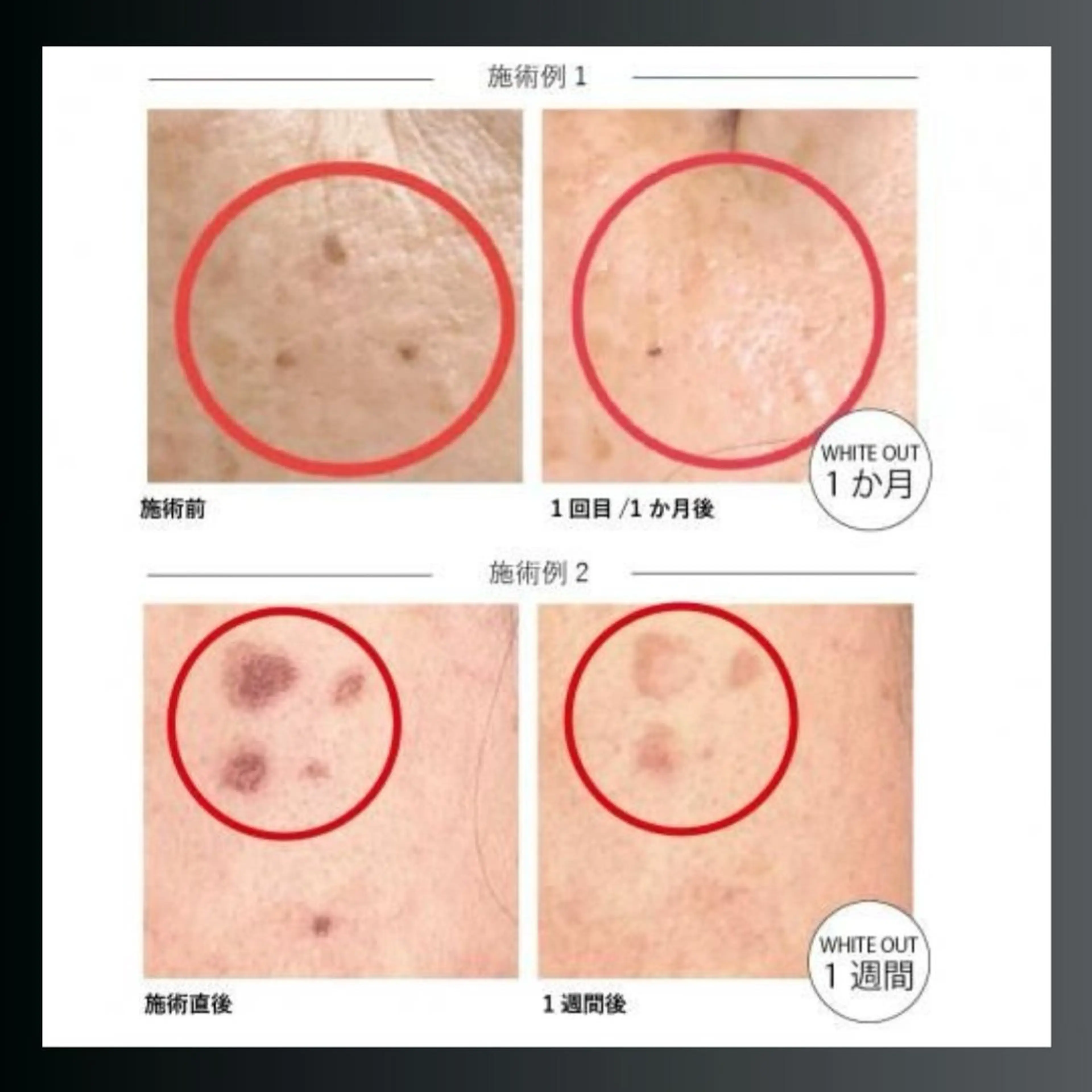 LiZA エステティックサロンのエステ・リラクイメージ