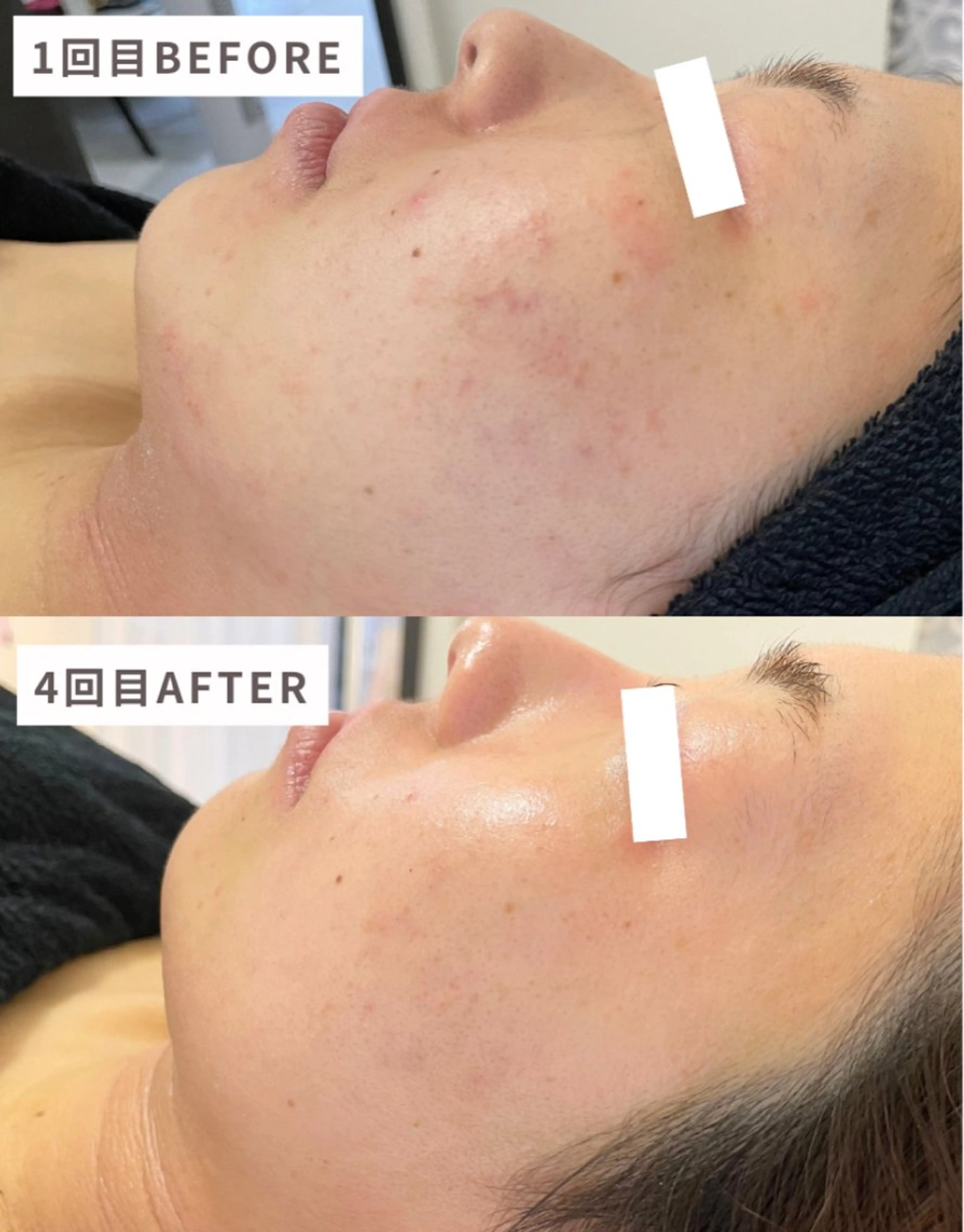 肌ケアサロン🌿 lapeca 土井のエステ・リラクイメージ