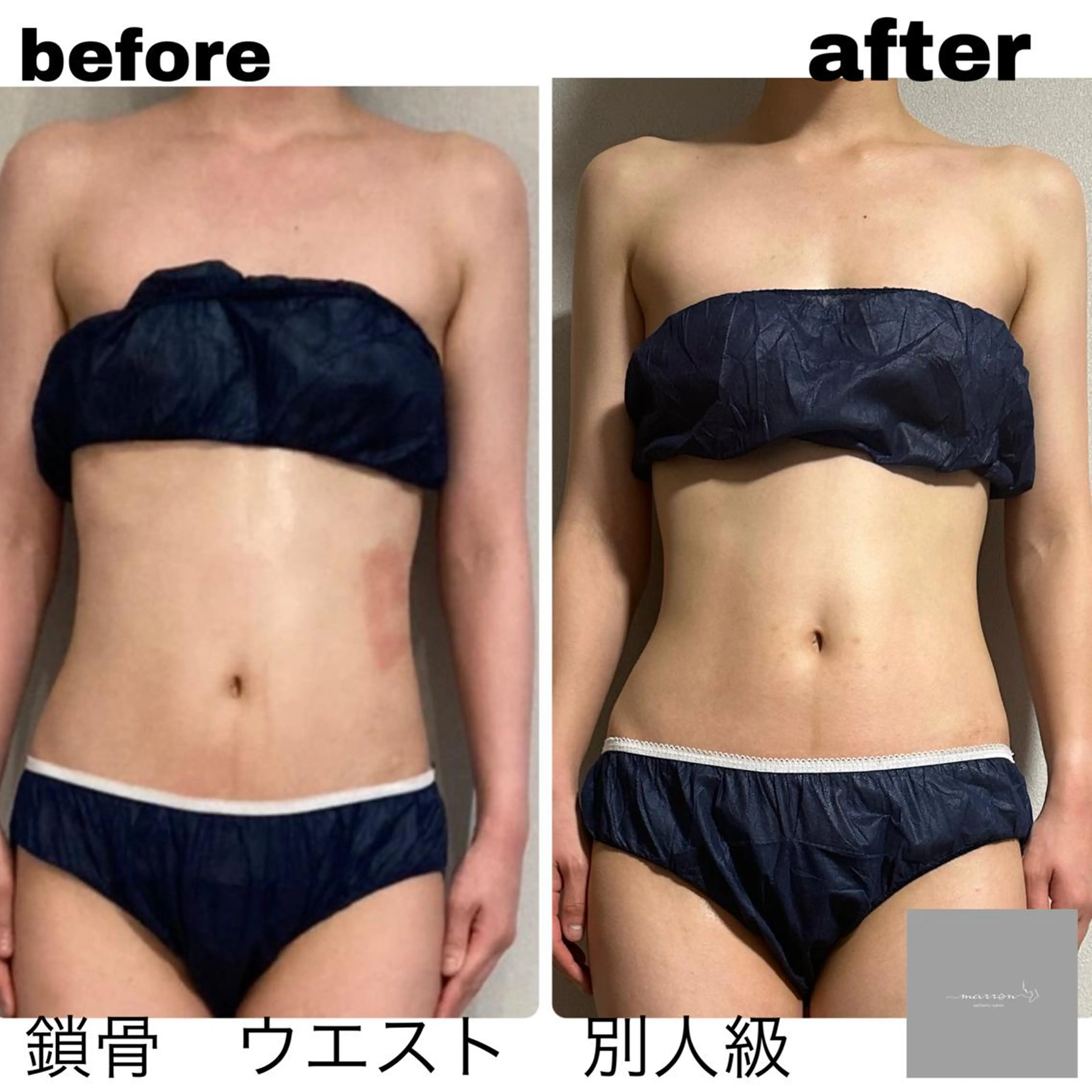 marron所属・痩身ハイパーナイフ ララピールリアボーテのエステ・リラクイメージ