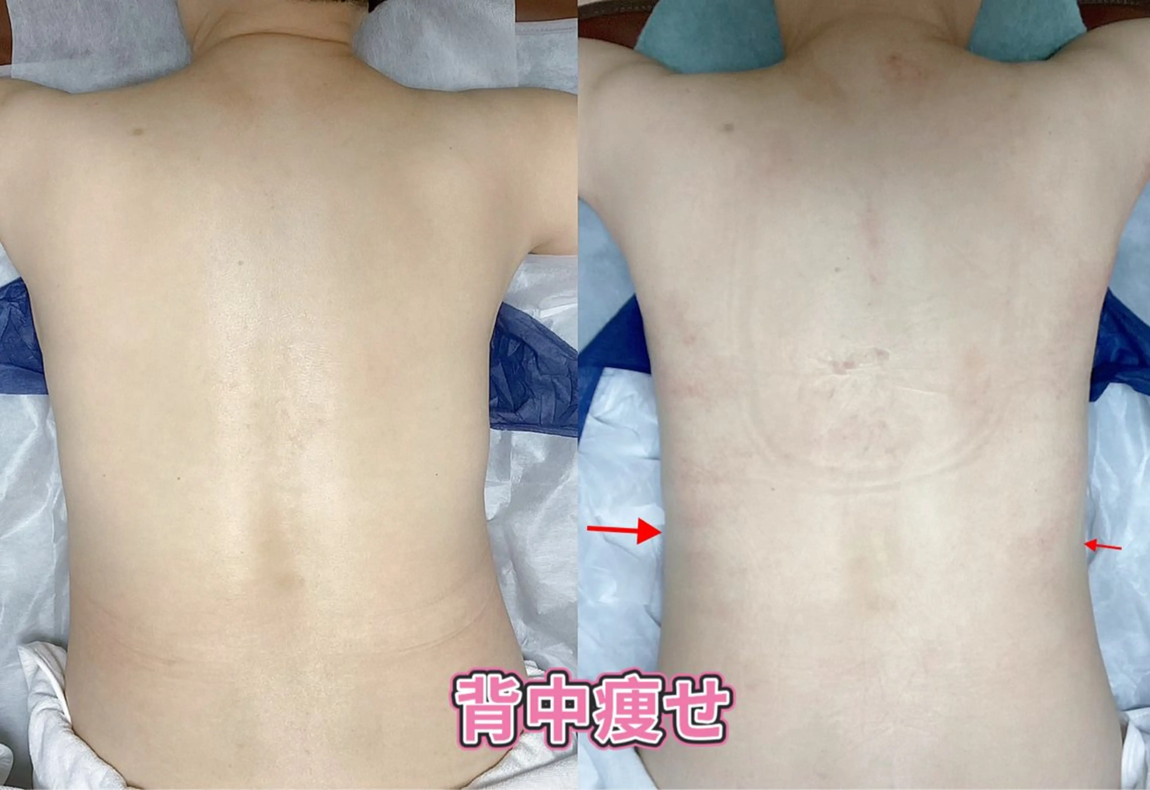 【新入社応援スペシャル】身体部分集中ボディスリムケアの写真