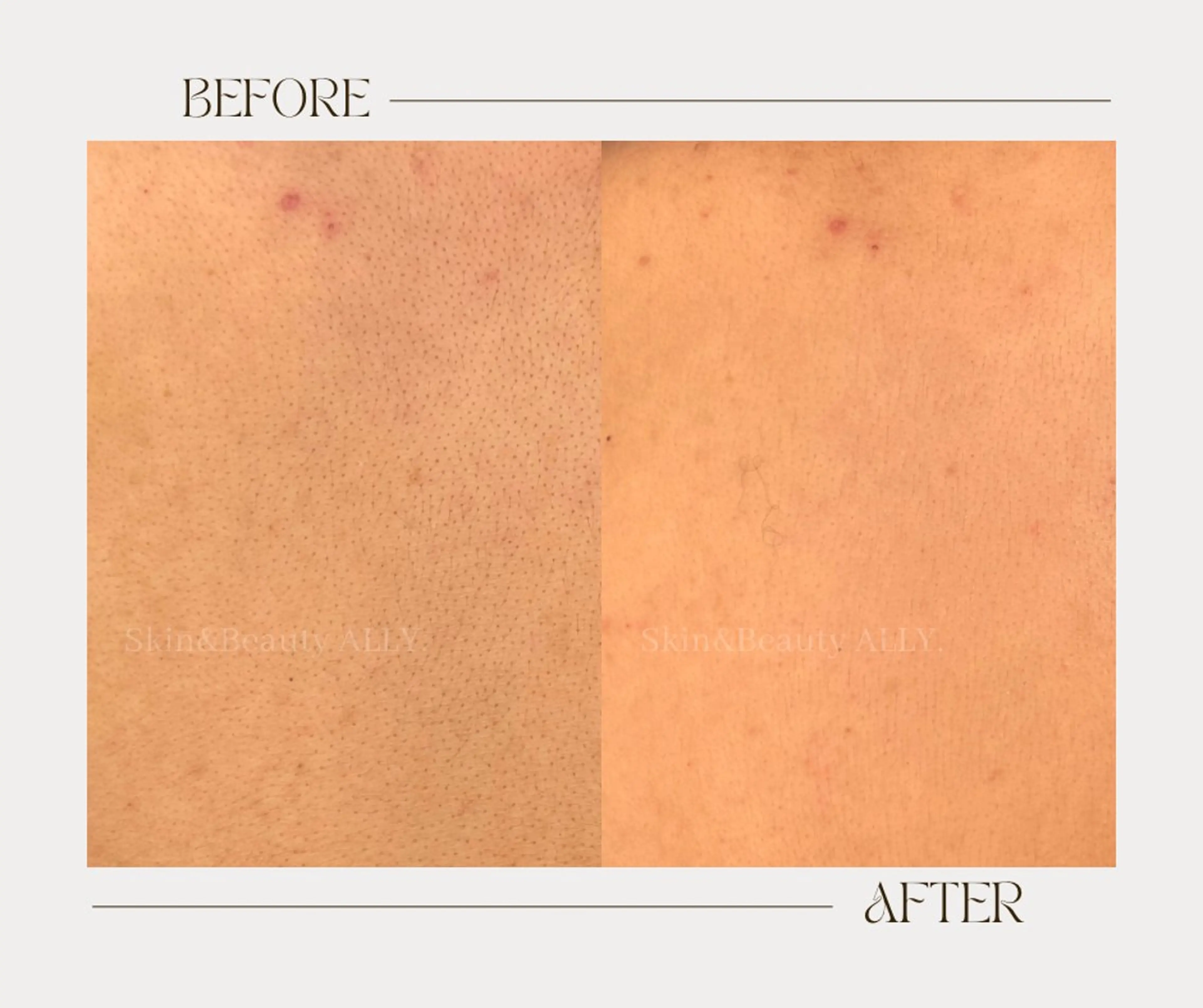 その他 艶肌ワックス ALLY.のエステ・リラクイメージ