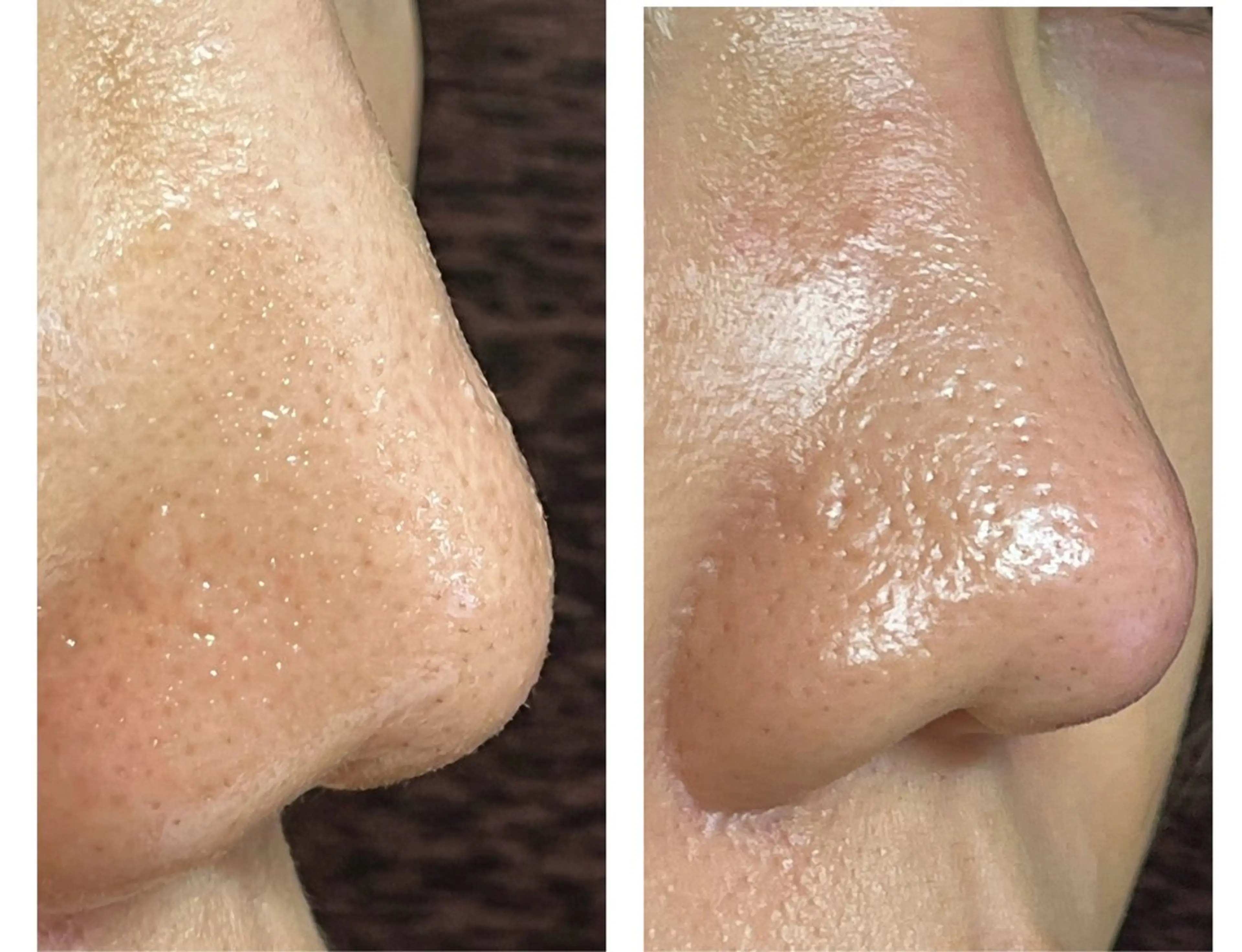 トータルビューティー マウロアのエステ・リラクイメージ