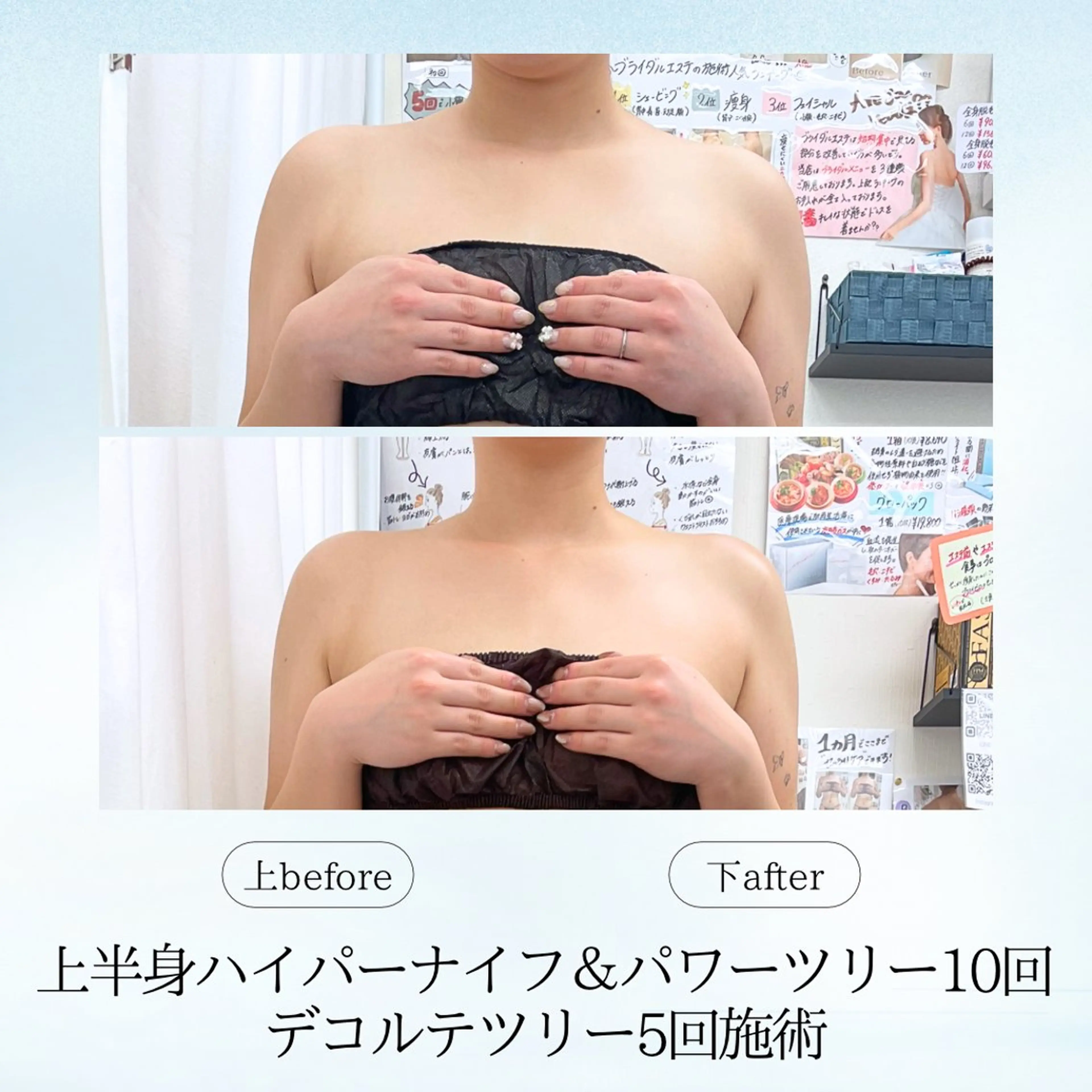 エステ リラク 《痩身、小顔専門店》 エスプレッソのエステ・リラクイメージ