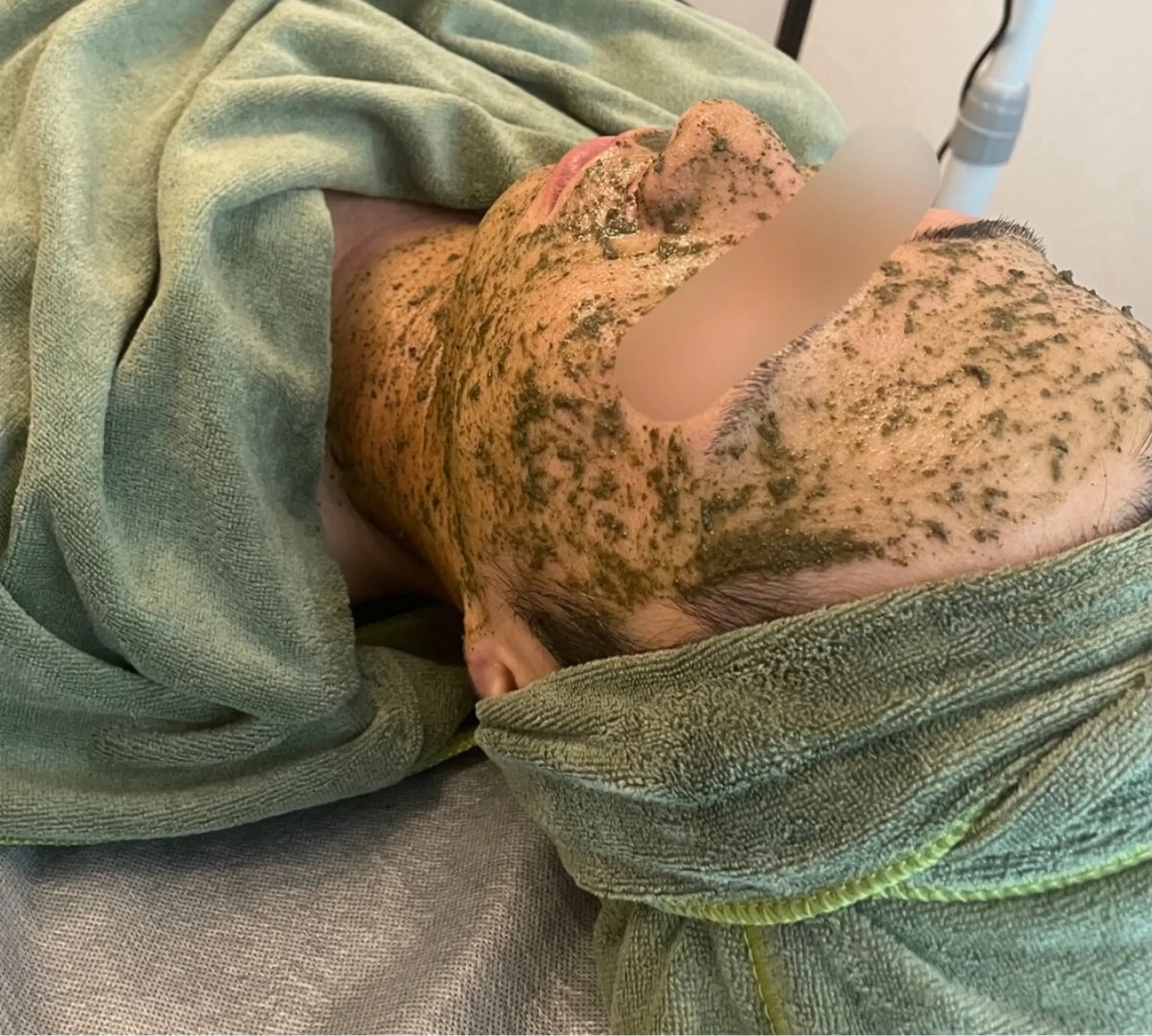 ニキビ/疲労回復ケア シェソワのエステ・リラクイメージ