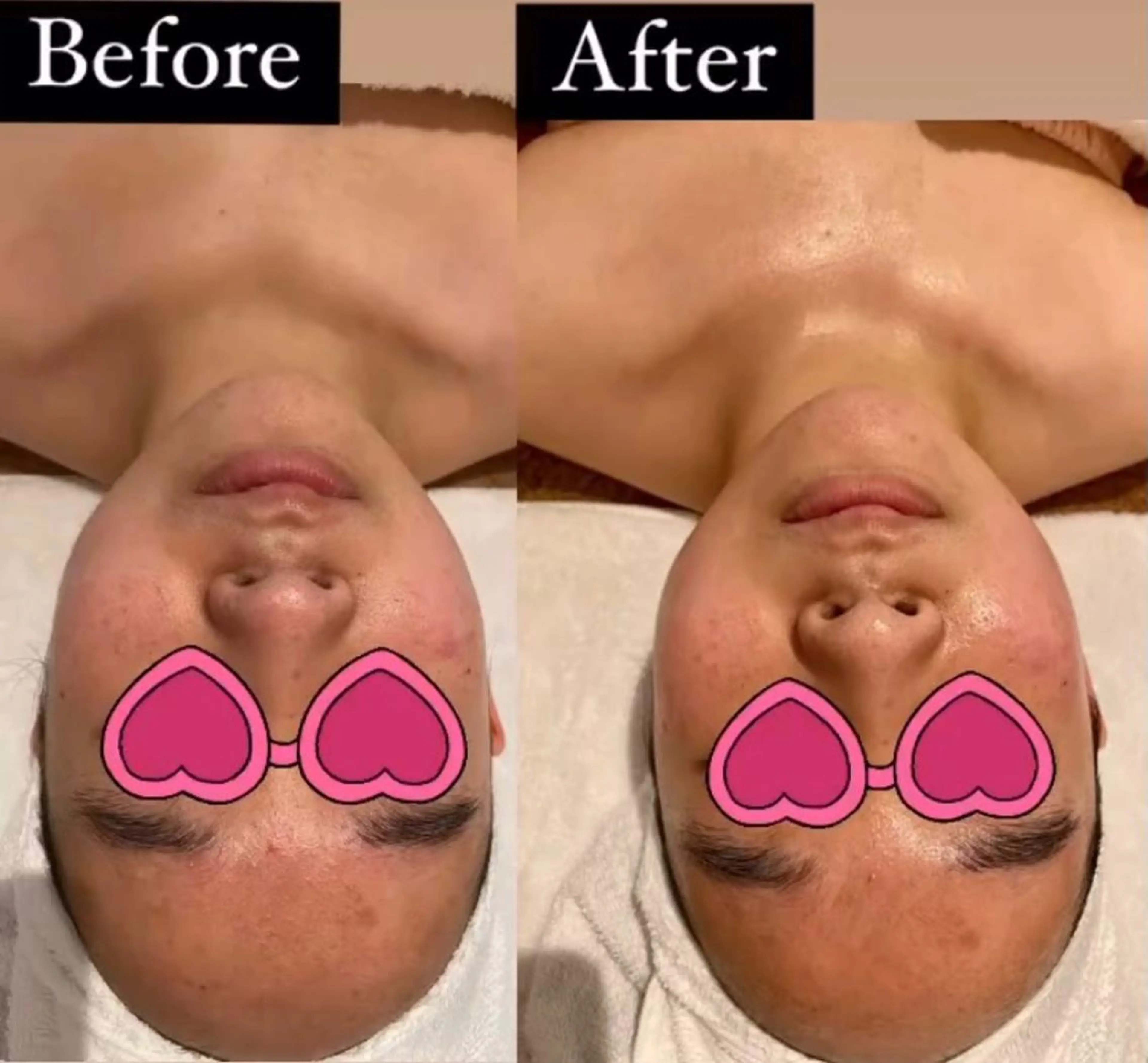 エステ リラク MENARD BLOOMのエステ・リラクイメージ