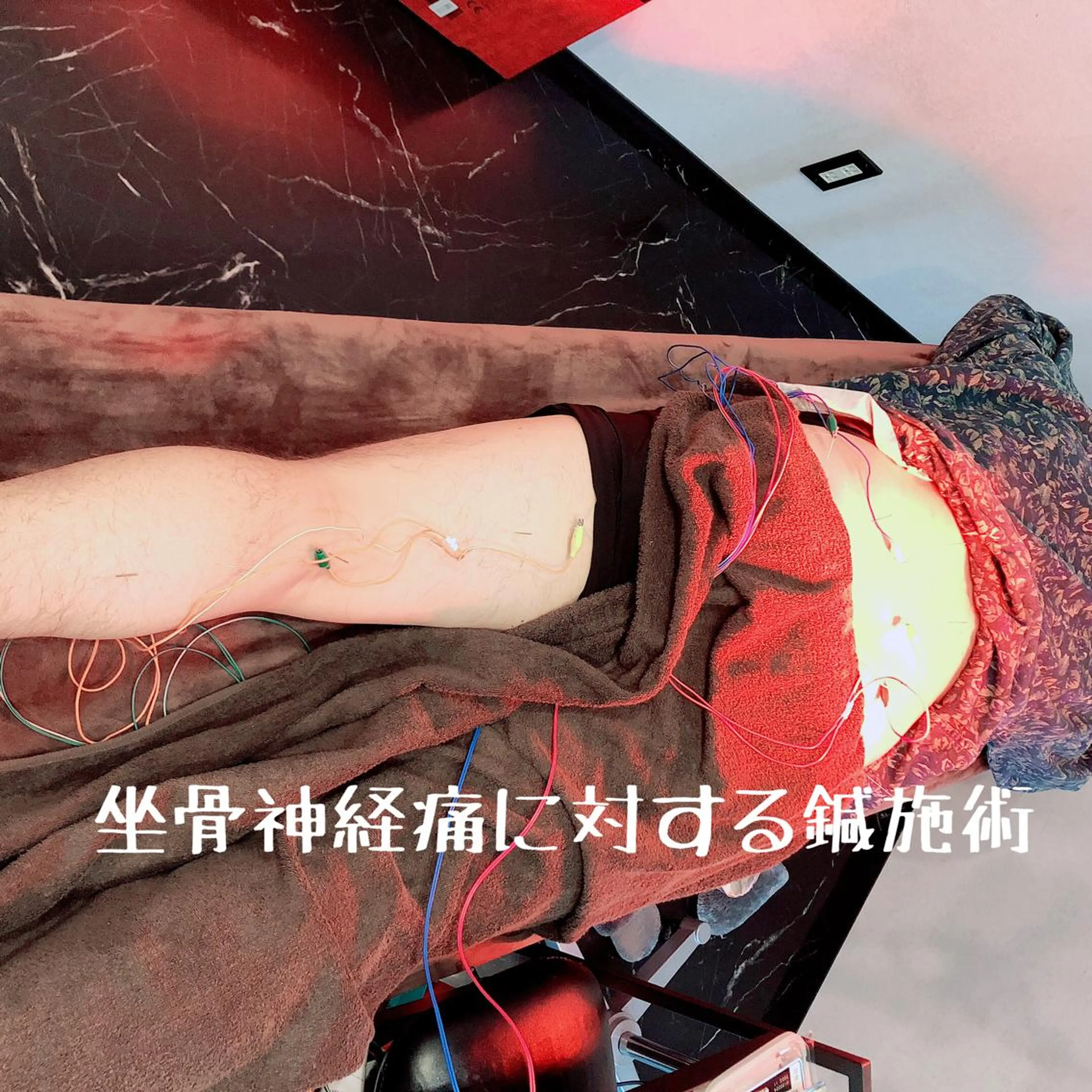 小顔矯/美容鍼/鍼灸 BeauJuのその他イメージ