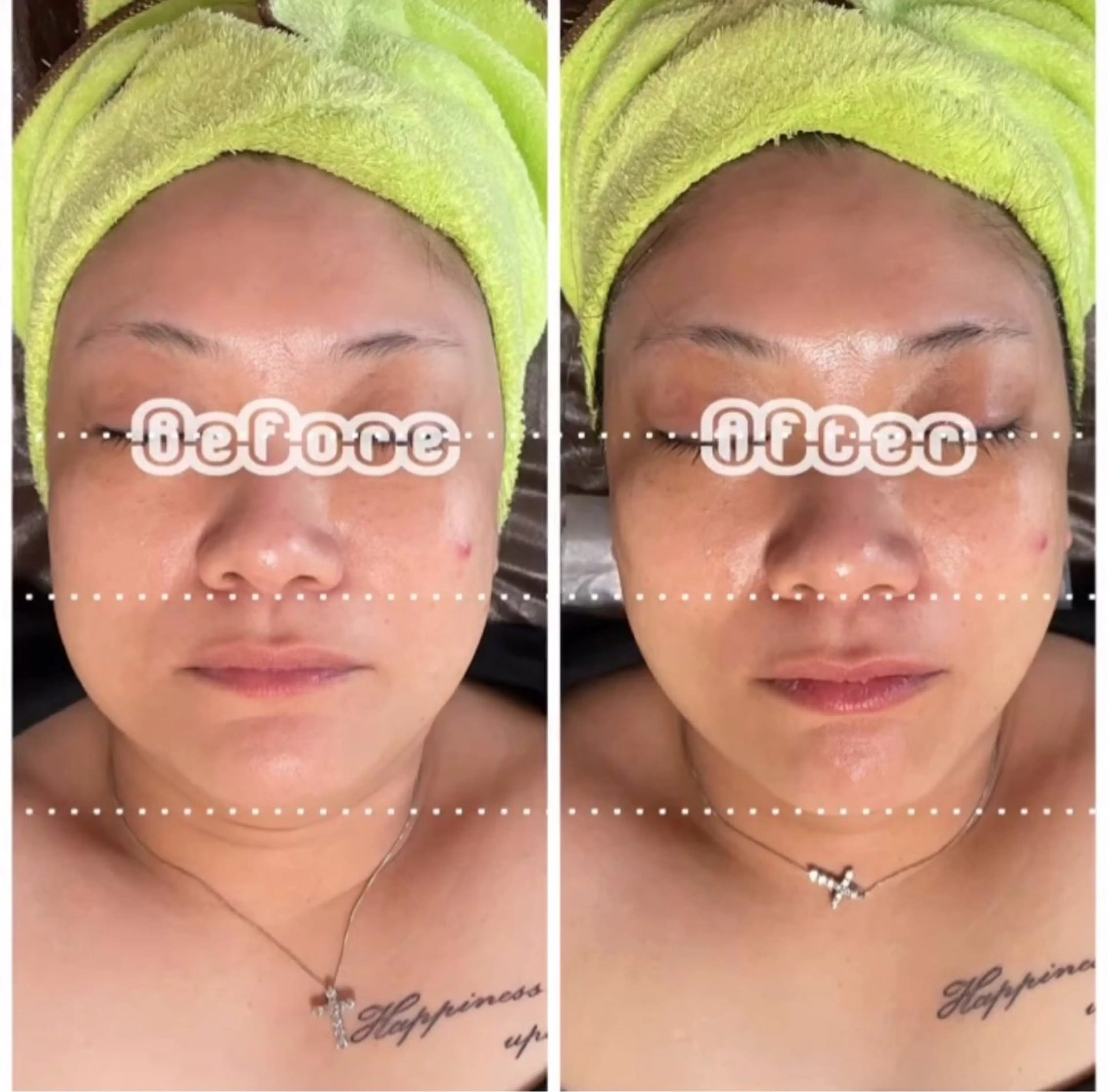 あだち整体エステ 首肩背中のゆるめぐのエステ・リラクイメージ