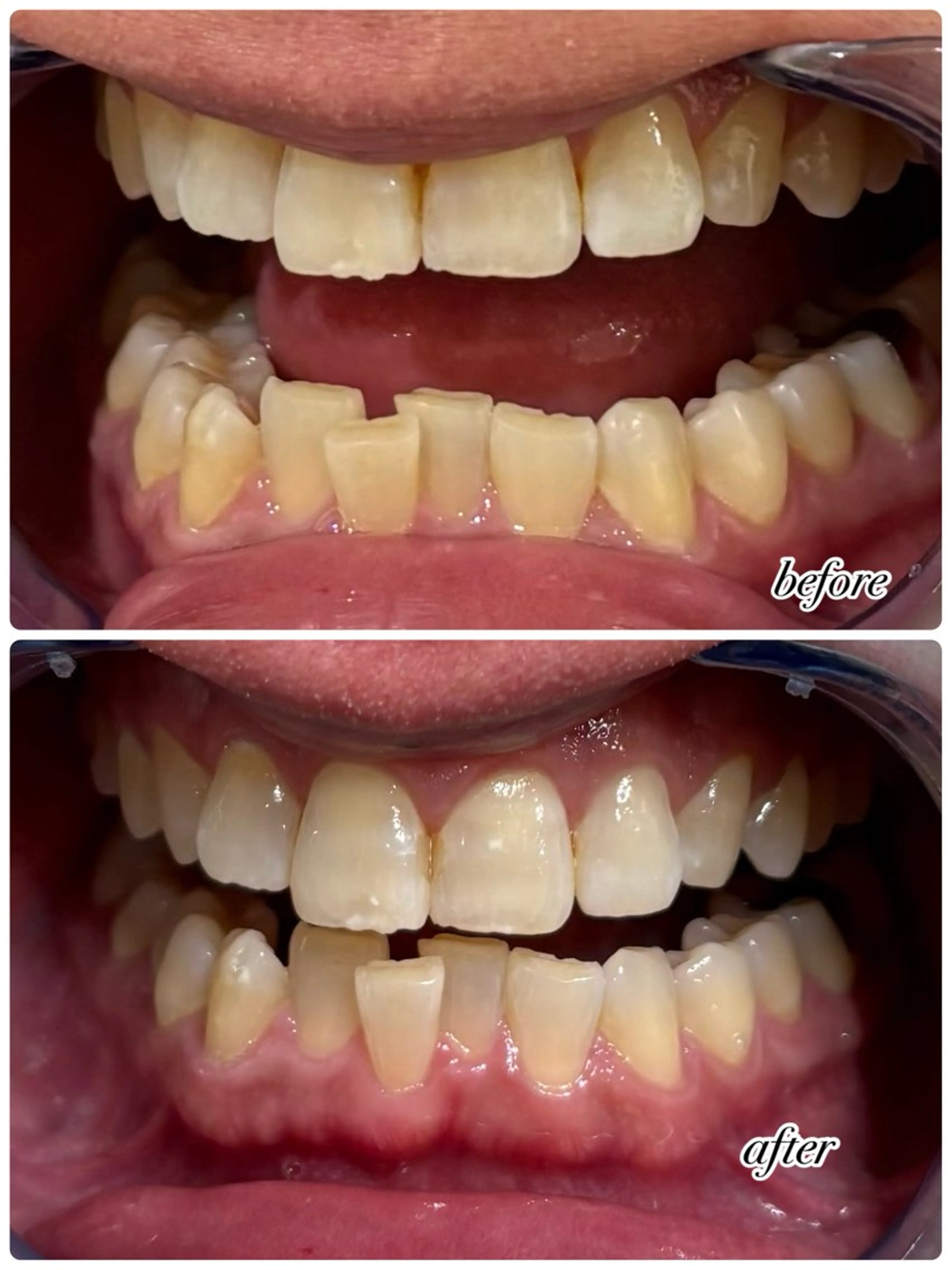 男性脱毛サロン Tielu♔.ﾟ所属・Tieiu ゆりのエステ・リラクイメージ