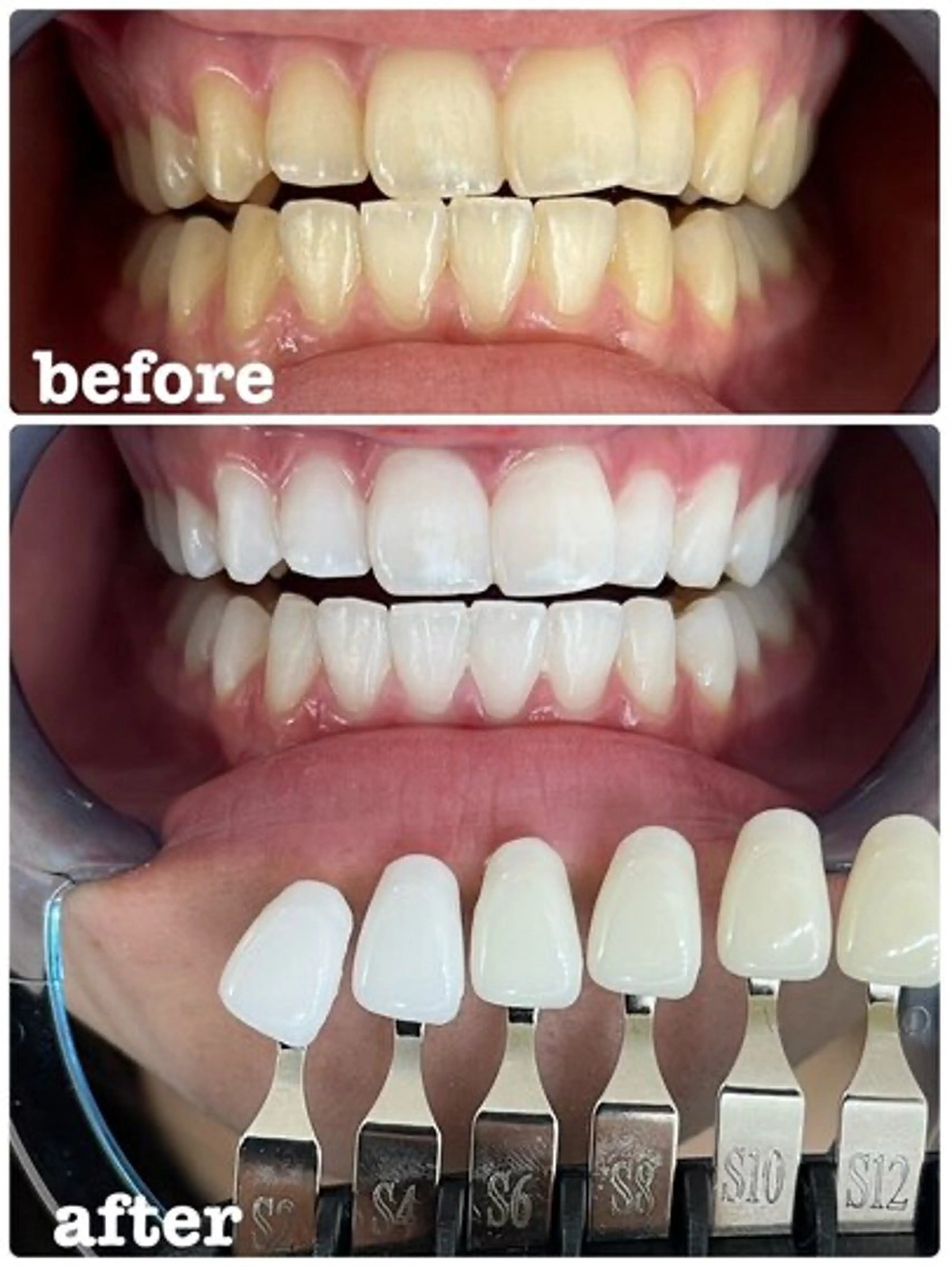 エクシア ホワイトニング西条店のその他イメージ