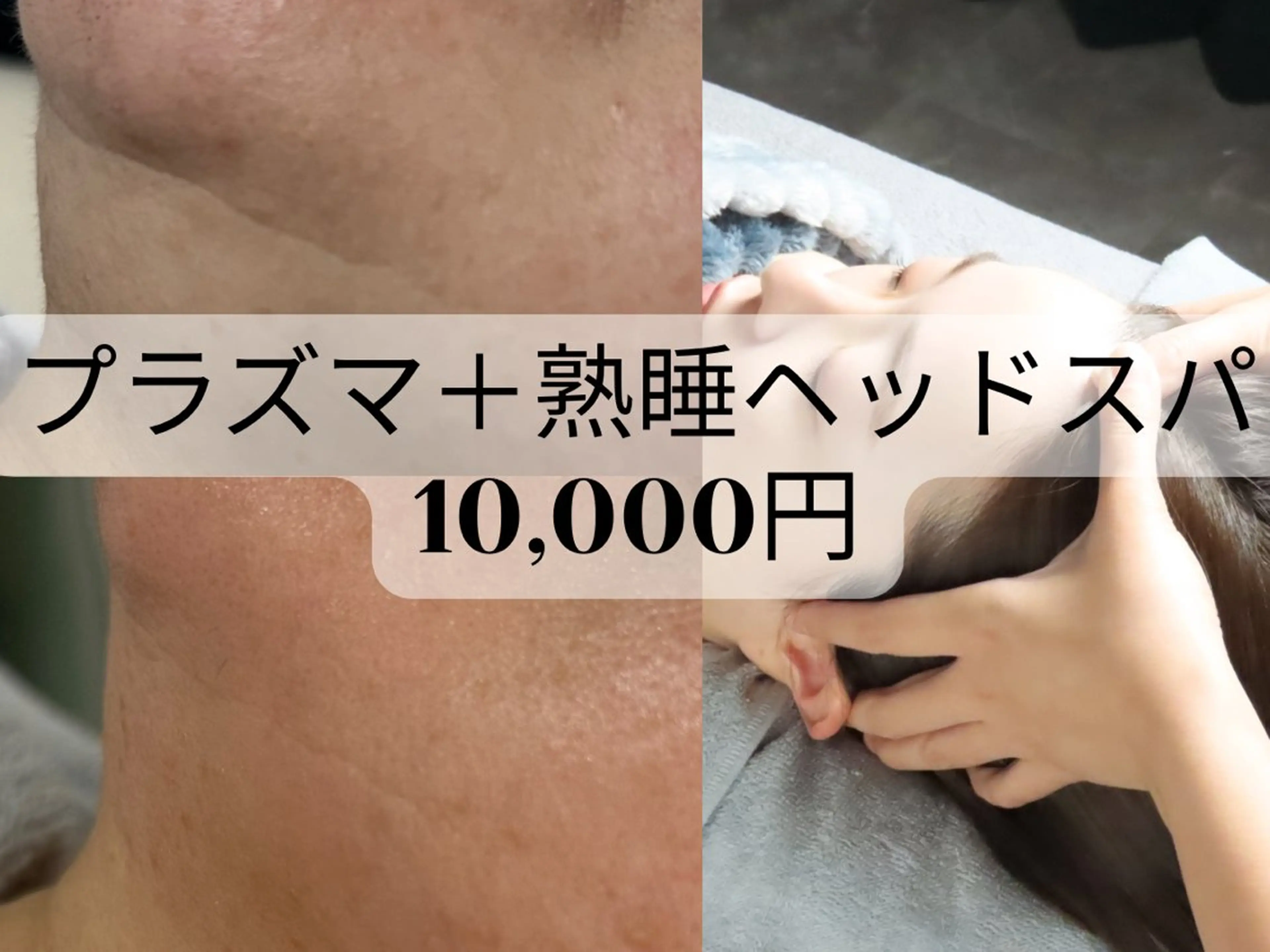 次世代ダーマプラズマ➕熟睡炭酸ドライヘッドスパ(３０分)の写真