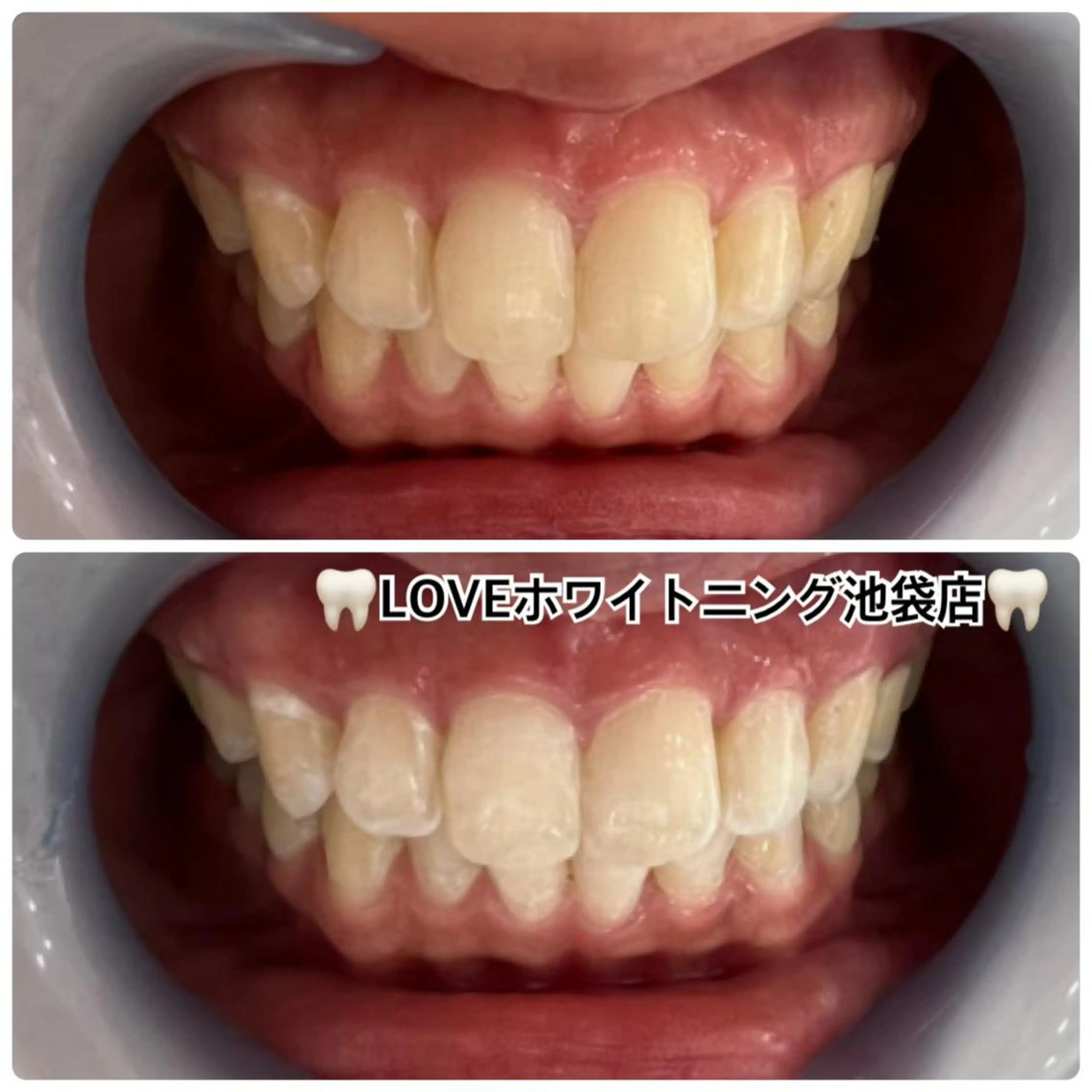 メンズ LOVEホワイト ニング恵比寿店のその他イメージ