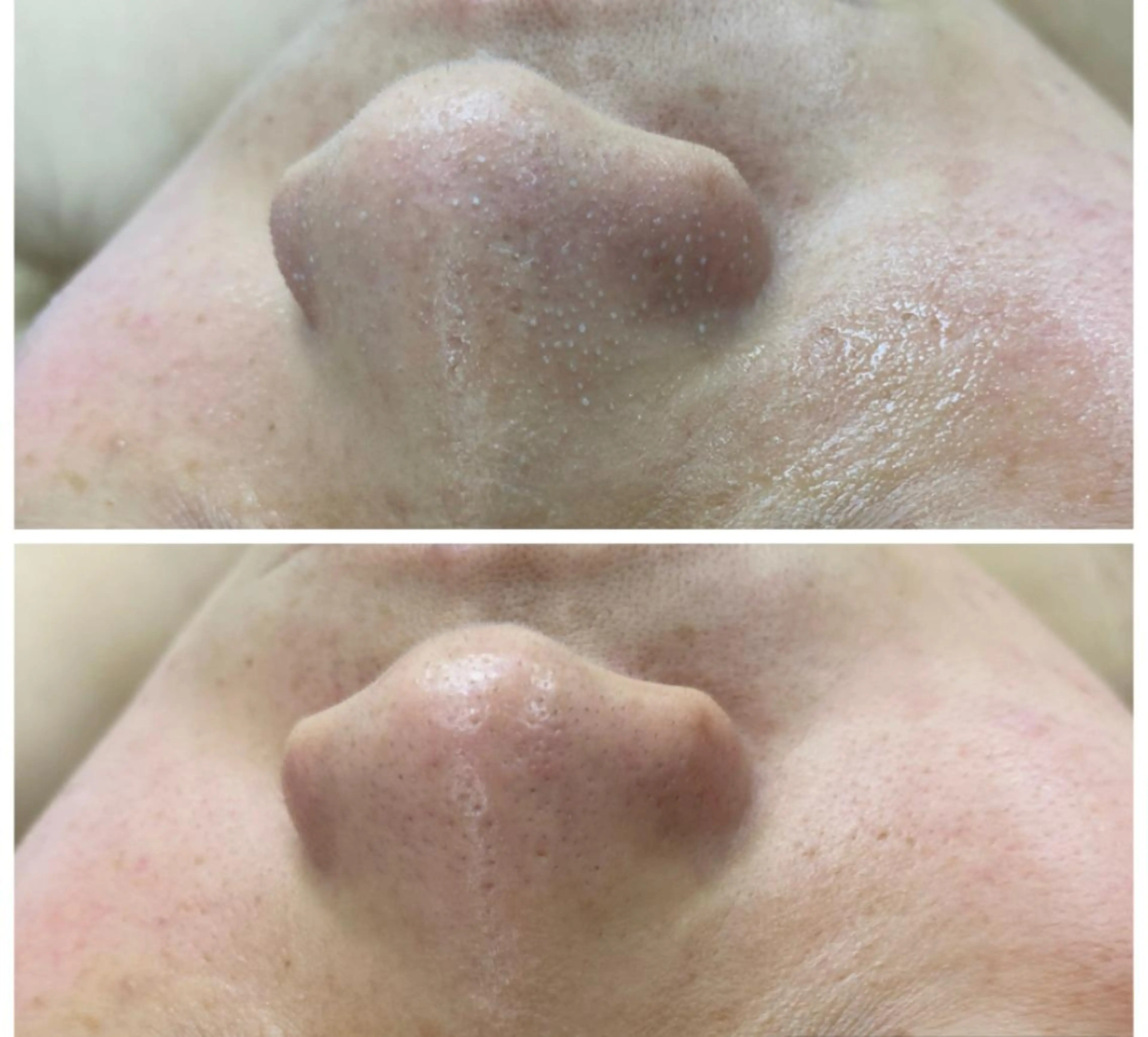 classynail beautyのエステ・リラクイメージ