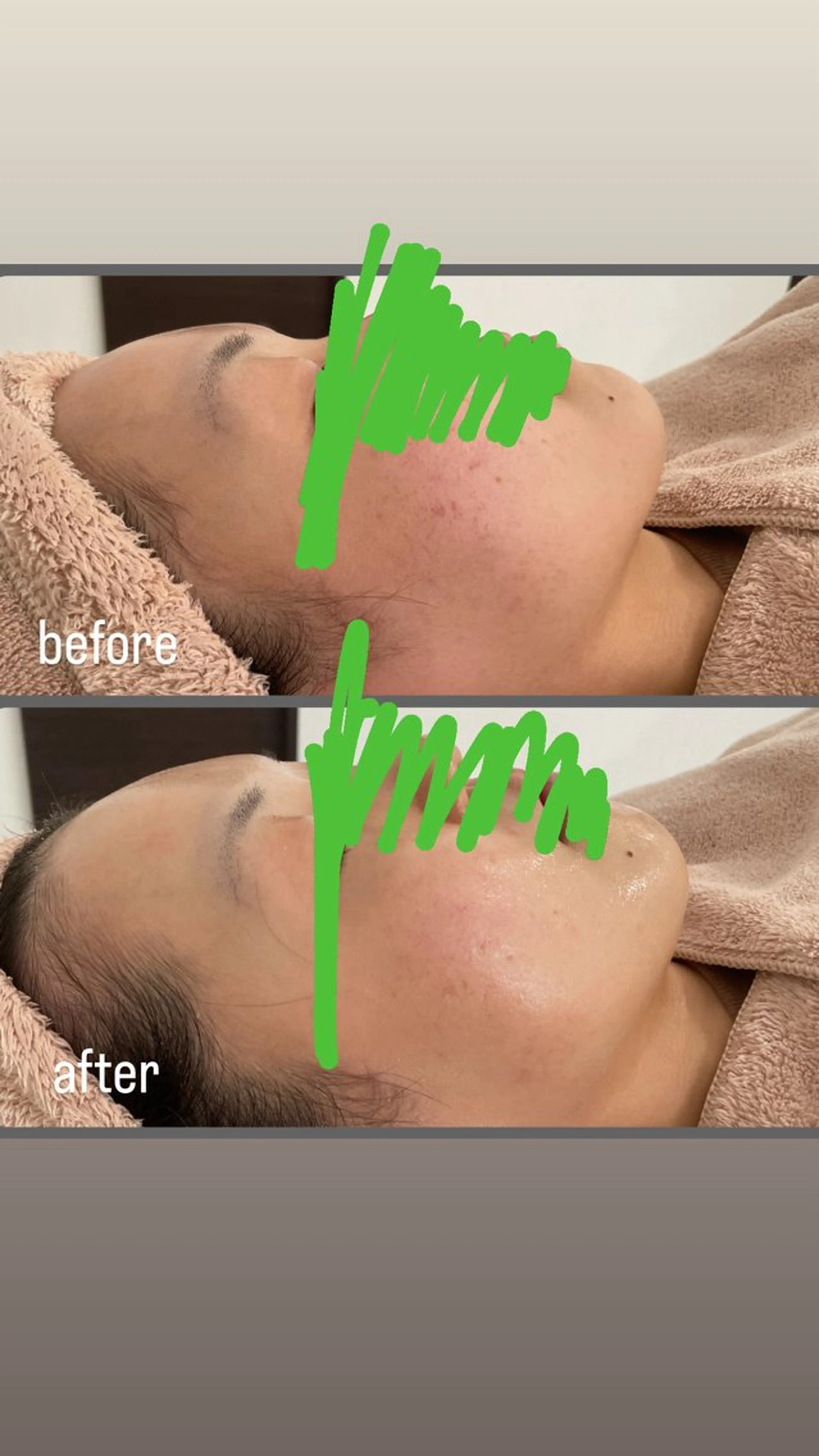 エステ Confile新潟所属・長谷川 由梨奈のエステ・リラクイメージ