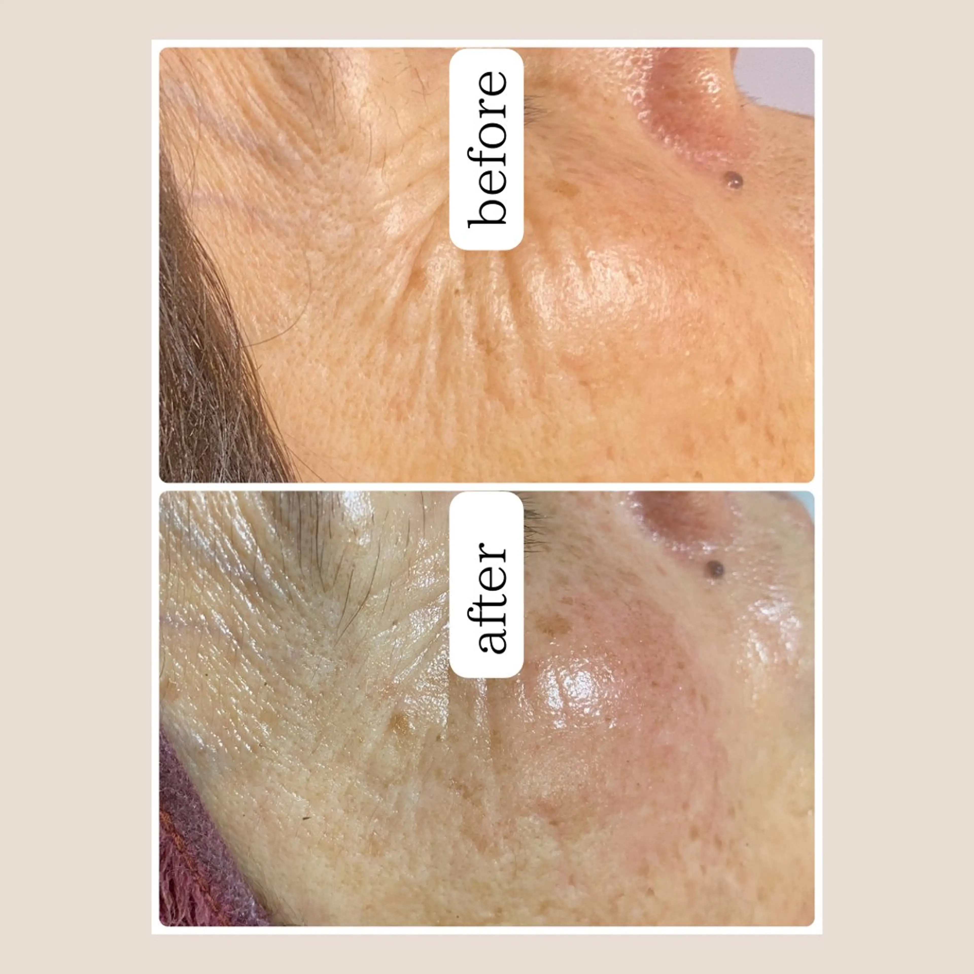 越猪 未来のネイルデザイン