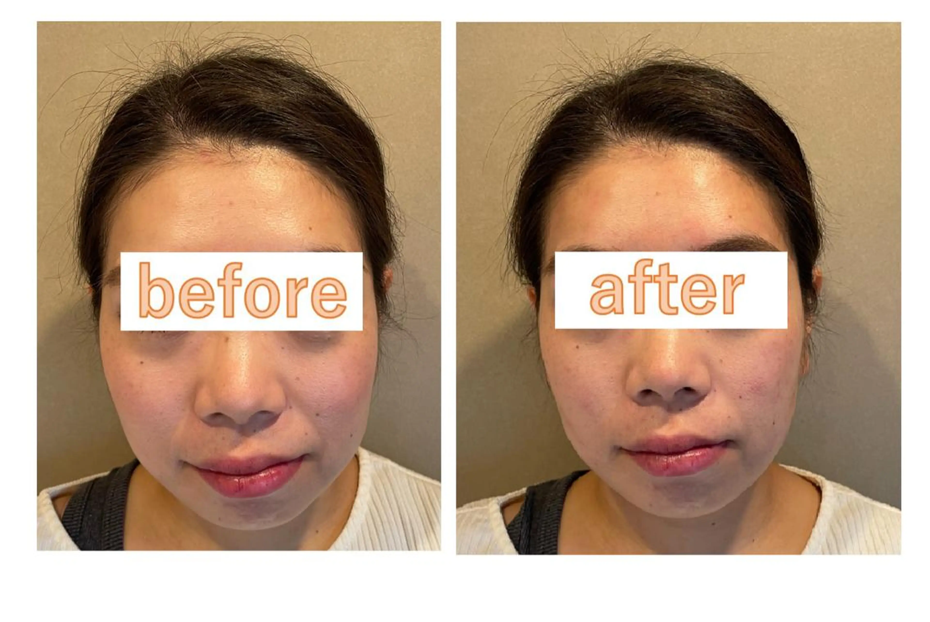 美容鍼灸サロン APLUSのエステ・リラクイメージ