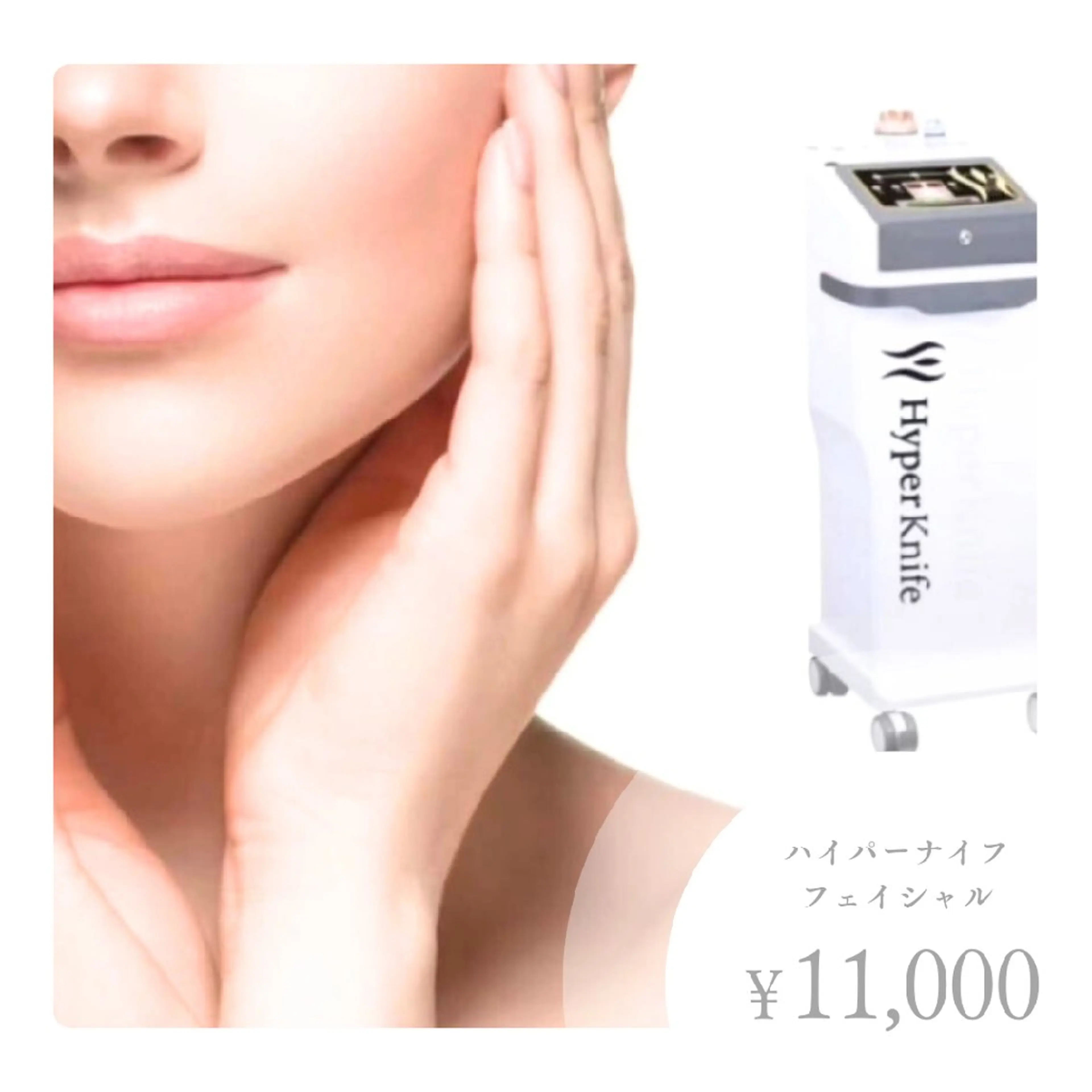 【フェイシャル】大人気☆ハイパーナイフフェイシャルの写真