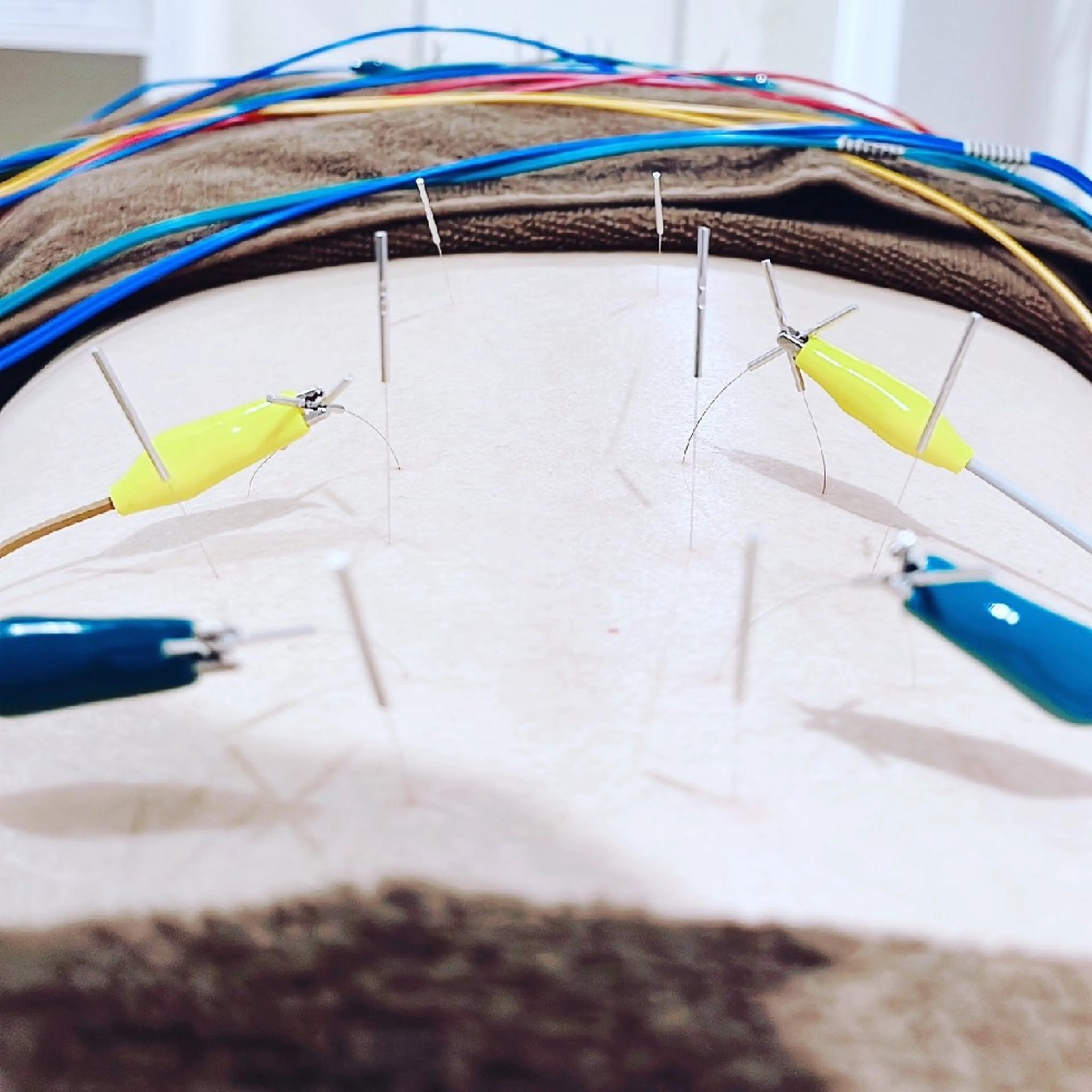 Spring鍼灸院所属・Spring鍼灸院 ✨首肩こり、腰痛に!のその他イメージ