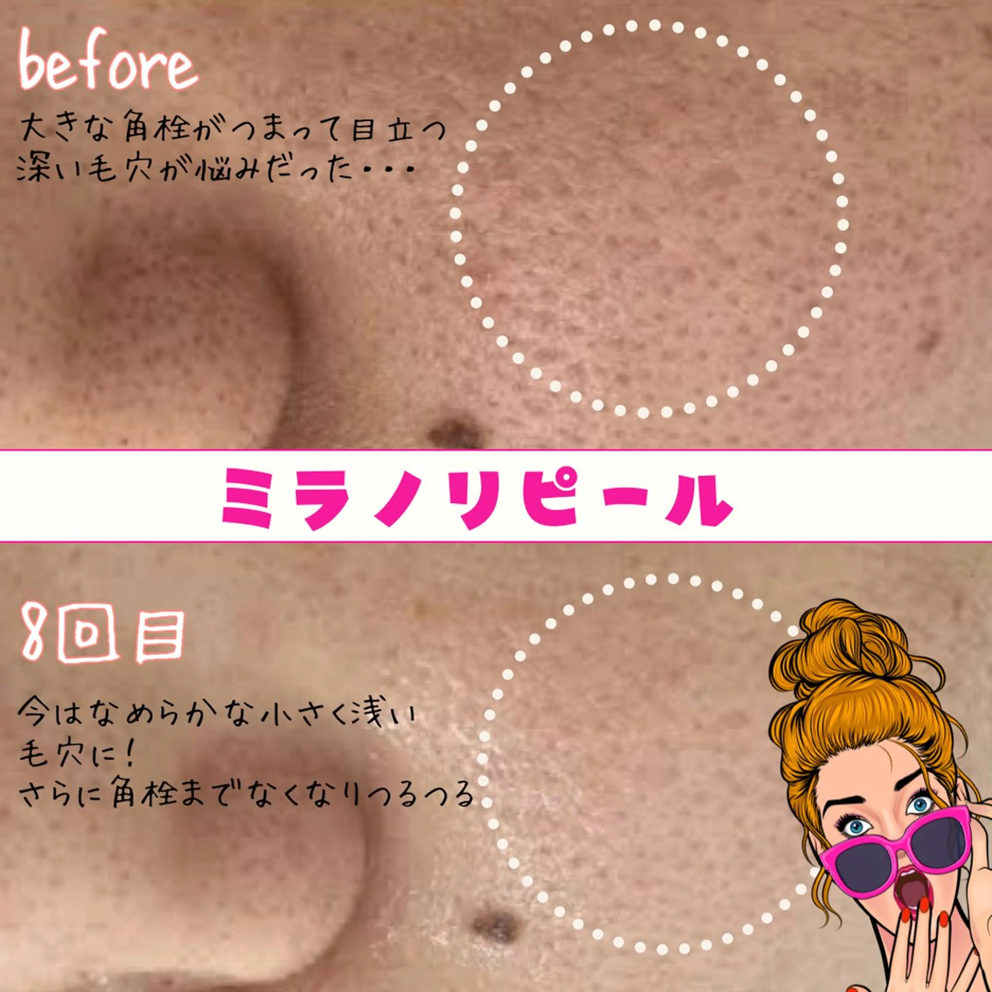 ミラノリピール全顔【2回目以降】の写真