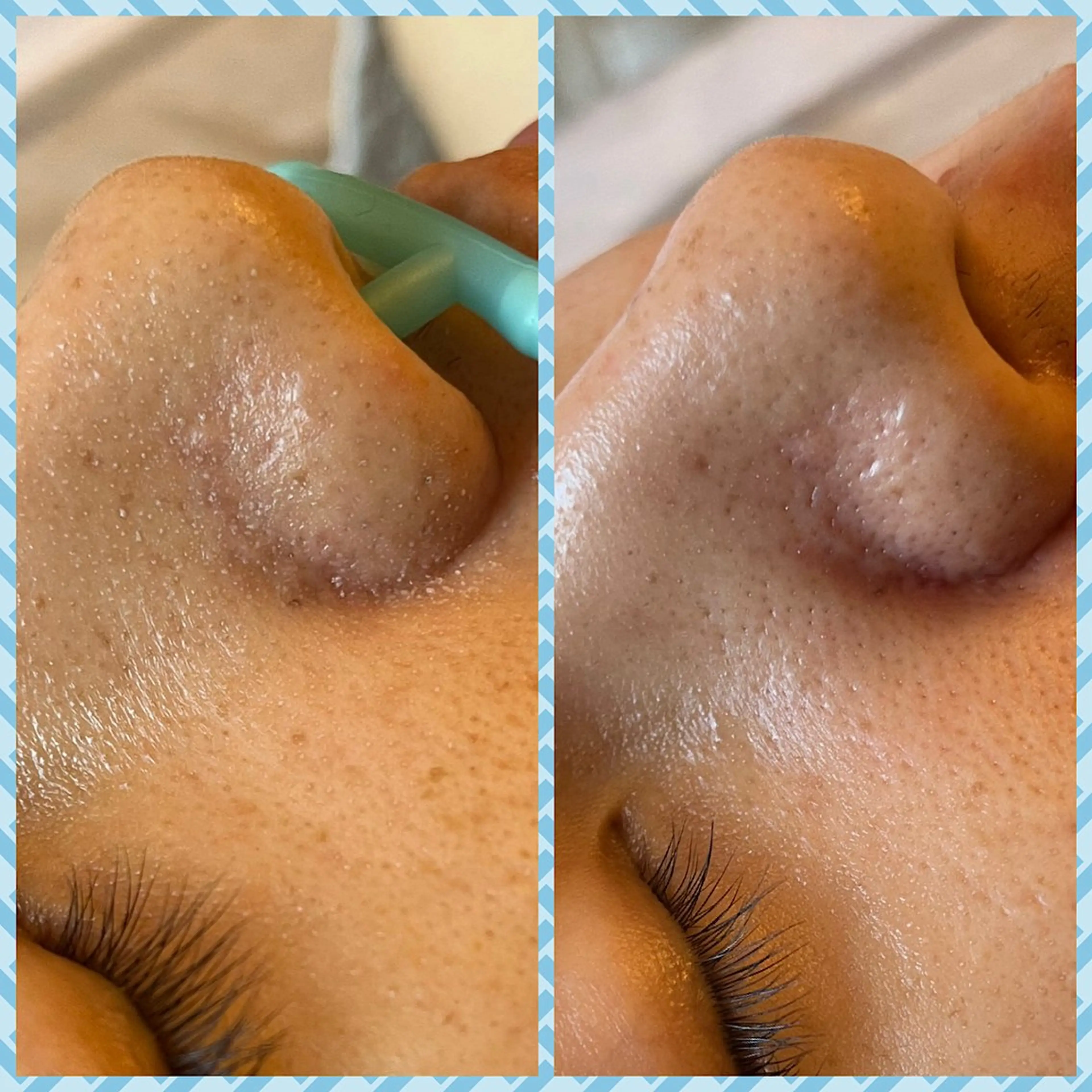 staff 山本のエステ・リラクイメージ