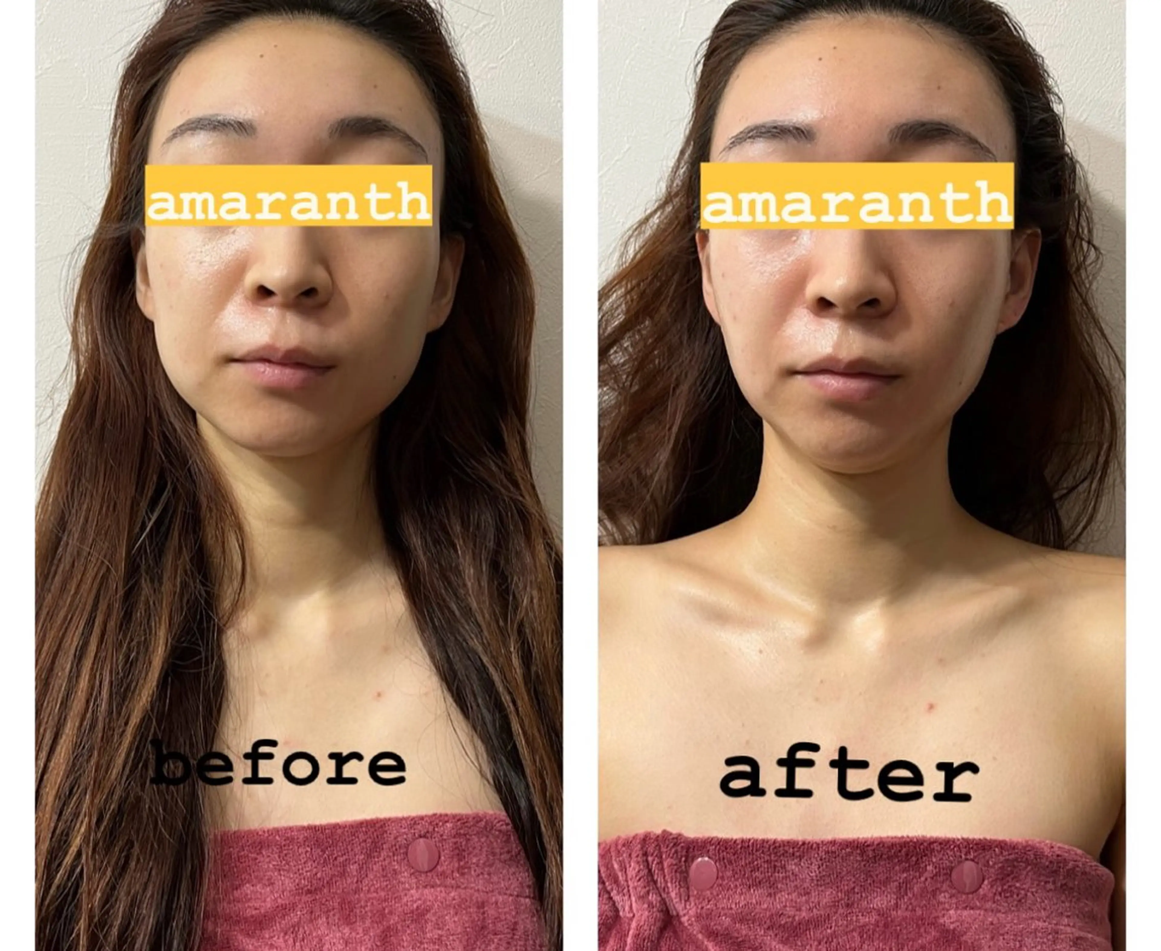 頭蓋骨小顔矯正 極眠ドライヘッド専門のエステ・リラクイメージ