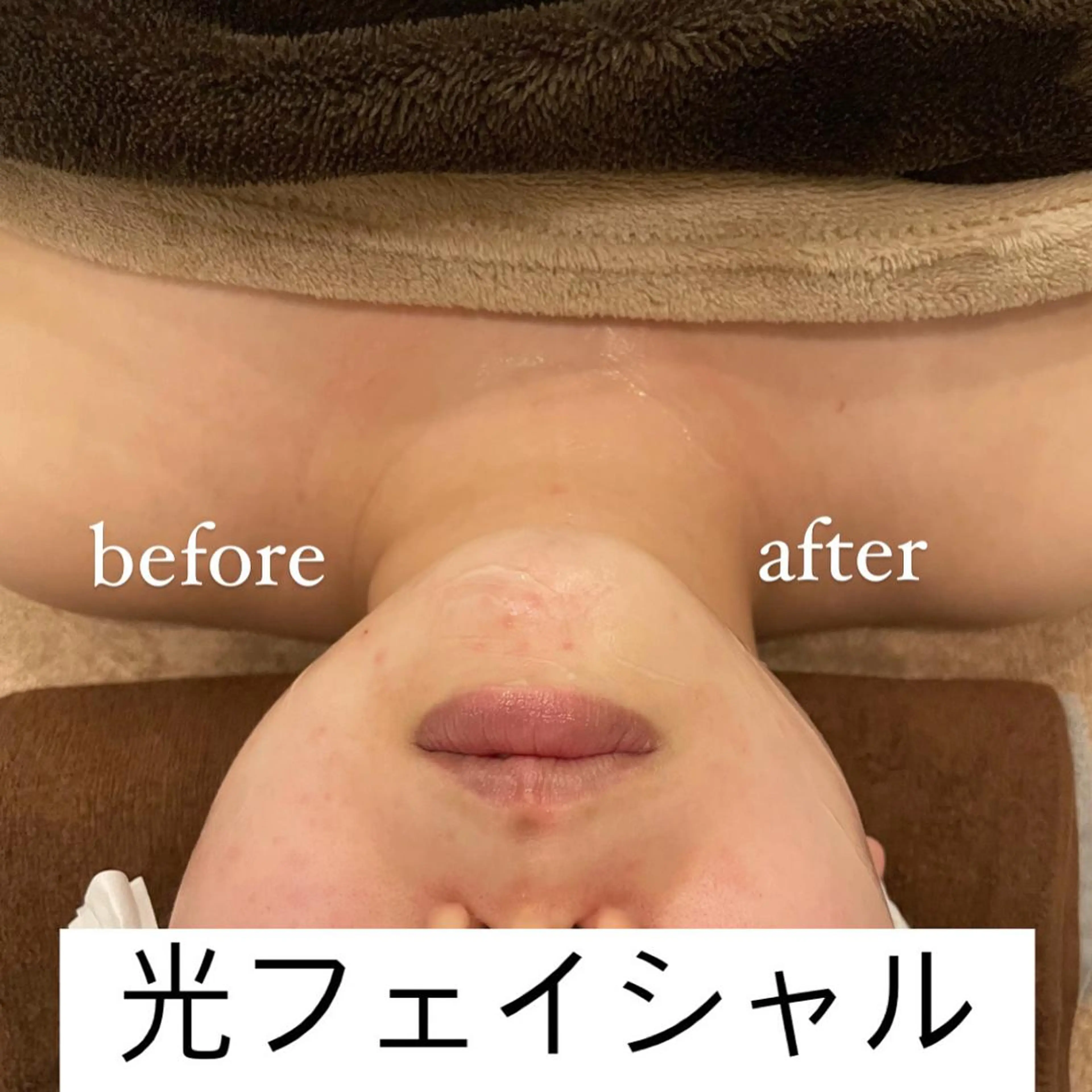 Rene 慢性疲労ケアサロンのエステ・リラクイメージ