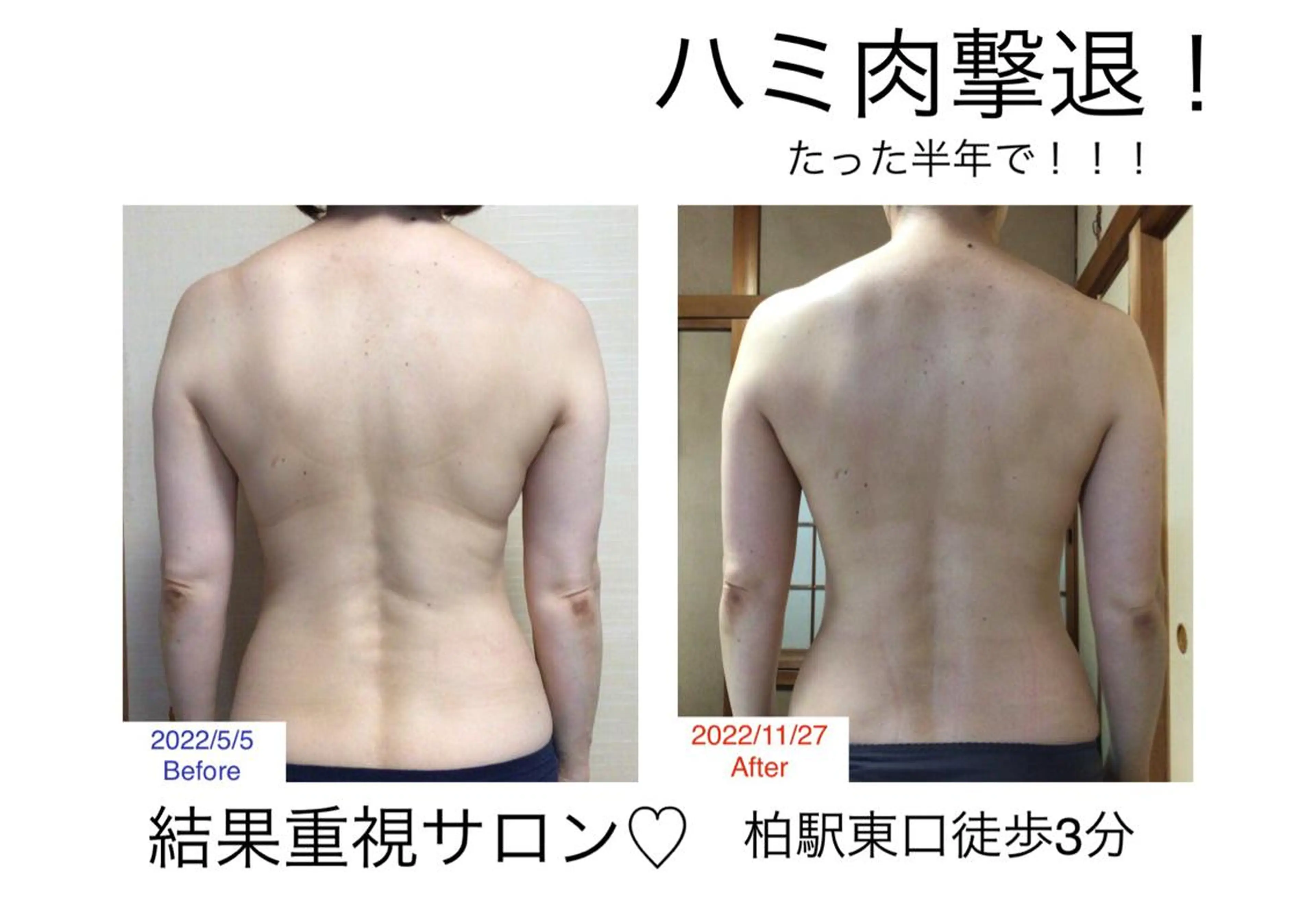 子宮矯正/腸揉み/ シュガーリング脱毛のエステ・リラクイメージ