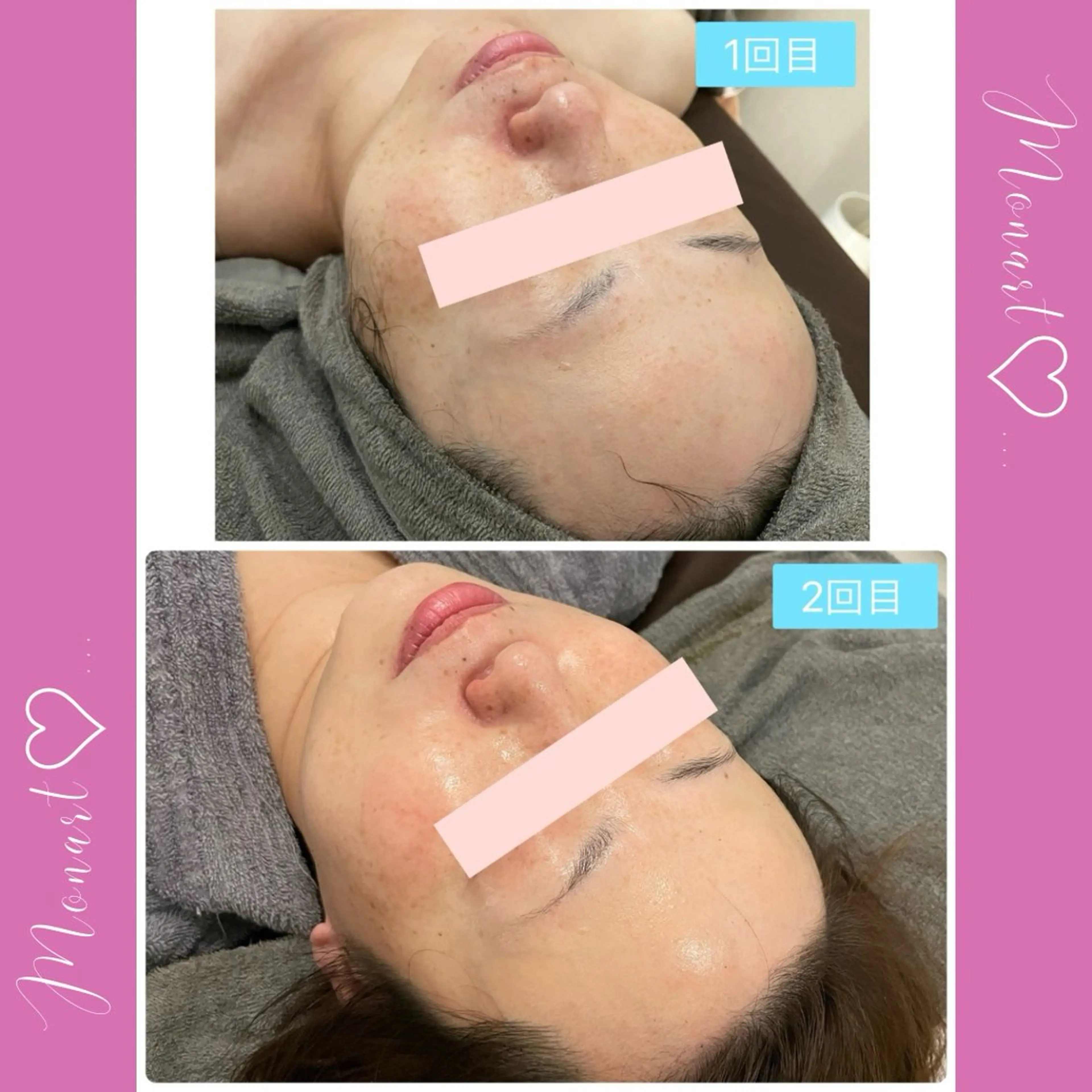 Monart -deux-のエステ・リラクイメージ