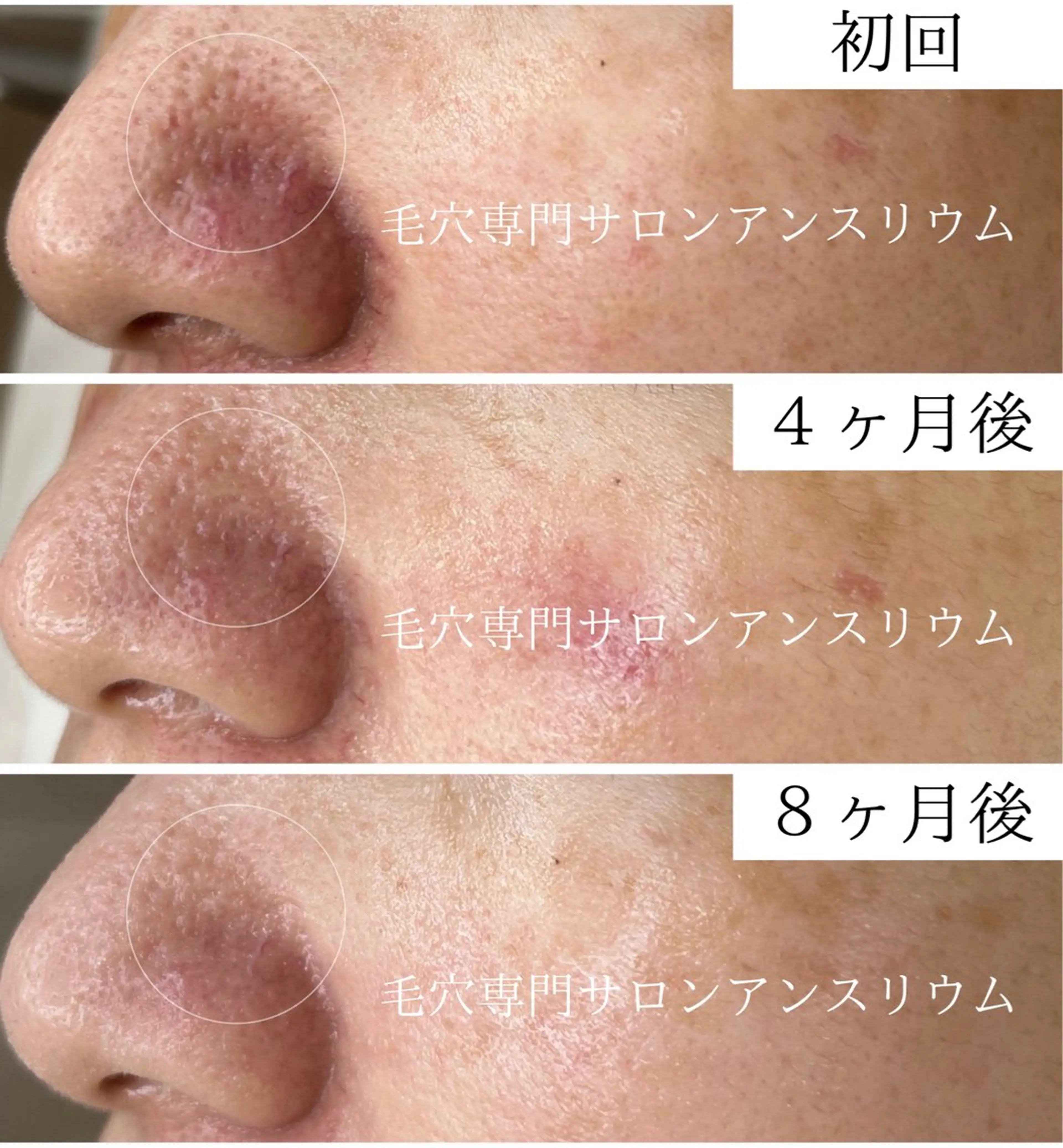 茨城土浦 つくば毛穴 ケア専門サロンのエステ・リラクイメージ