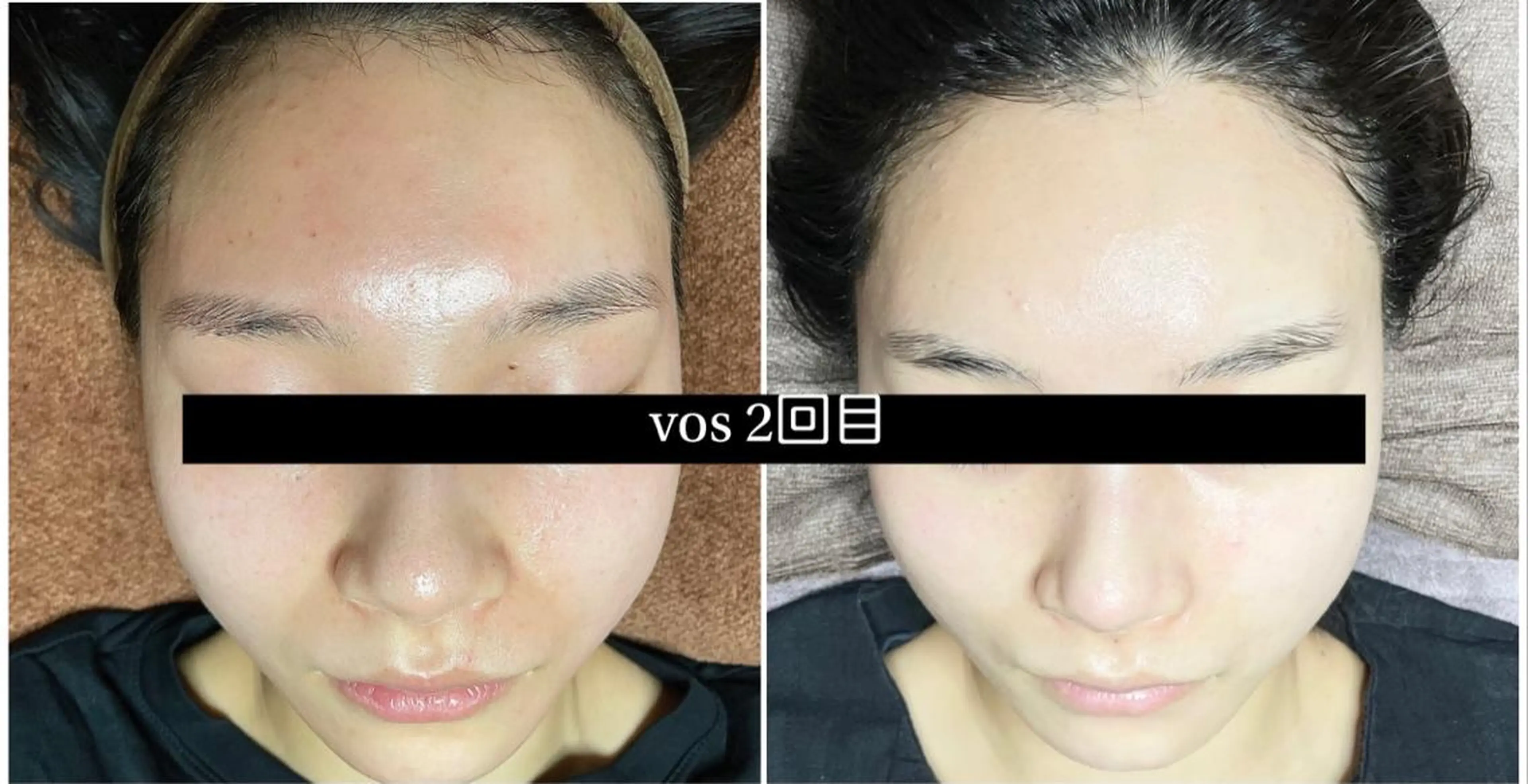 代表 MOMOのエステ・リラクイメージ