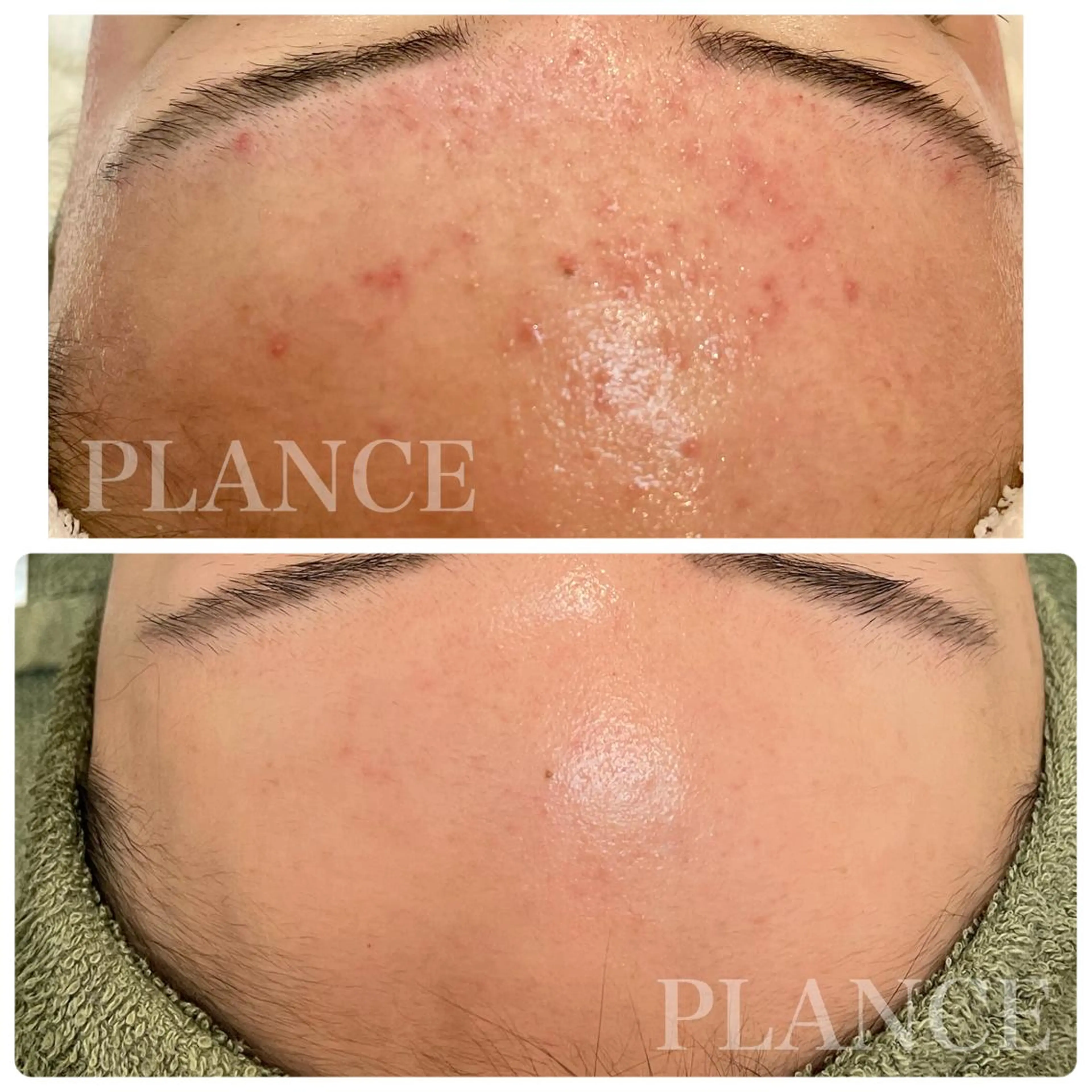 フェイシャル専門 肌質改善/プランスのエステ・リラクイメージ