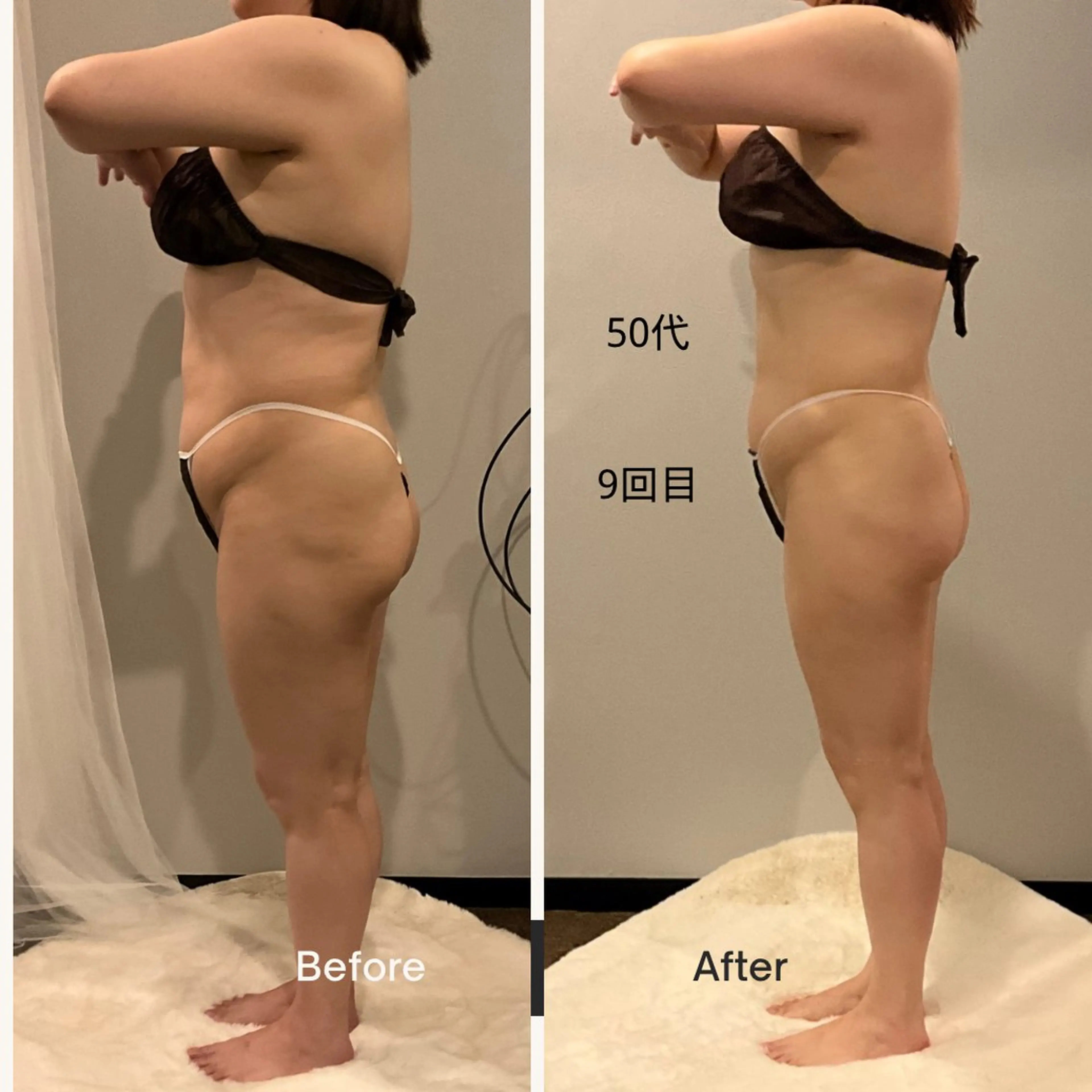 ✨痩身 ✨ハイパーナイフEXのエステ・リラクイメージ