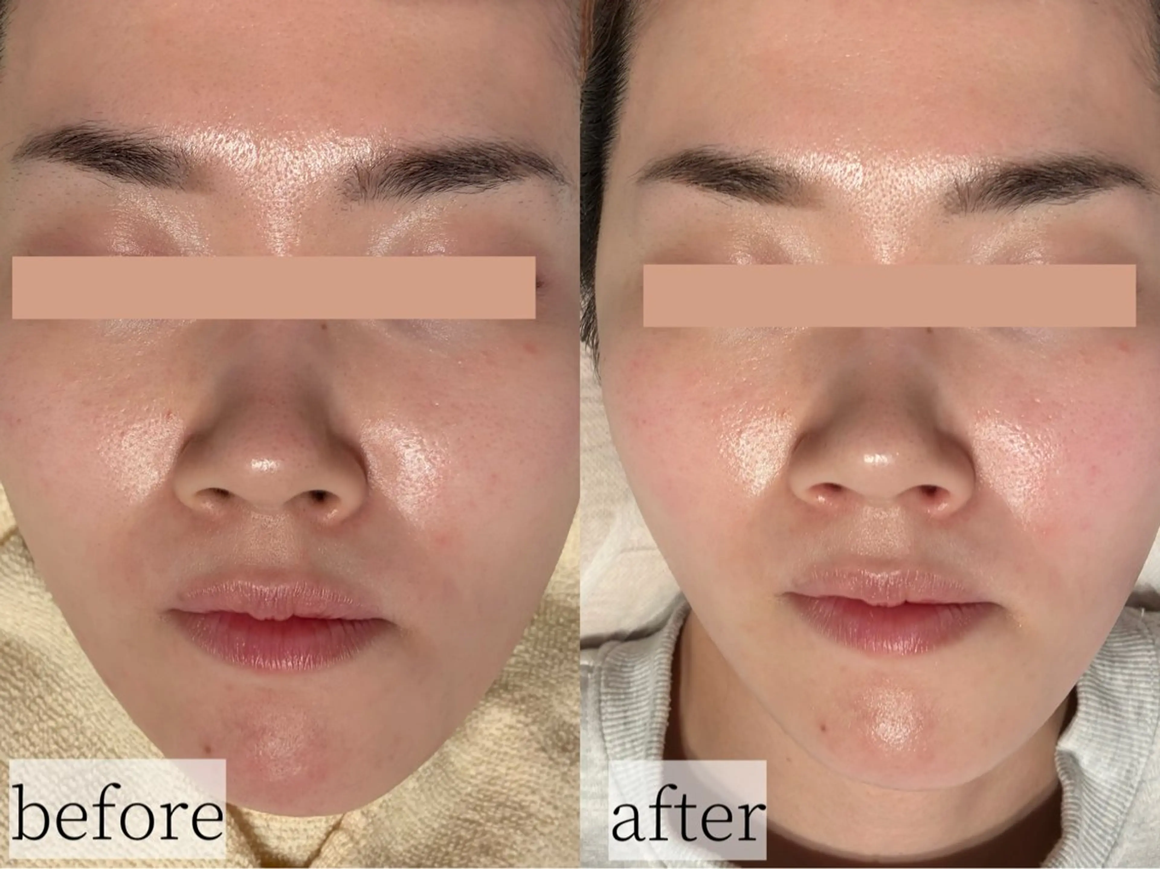 その他 Erika komorebi_のエステ・リラクイメージ