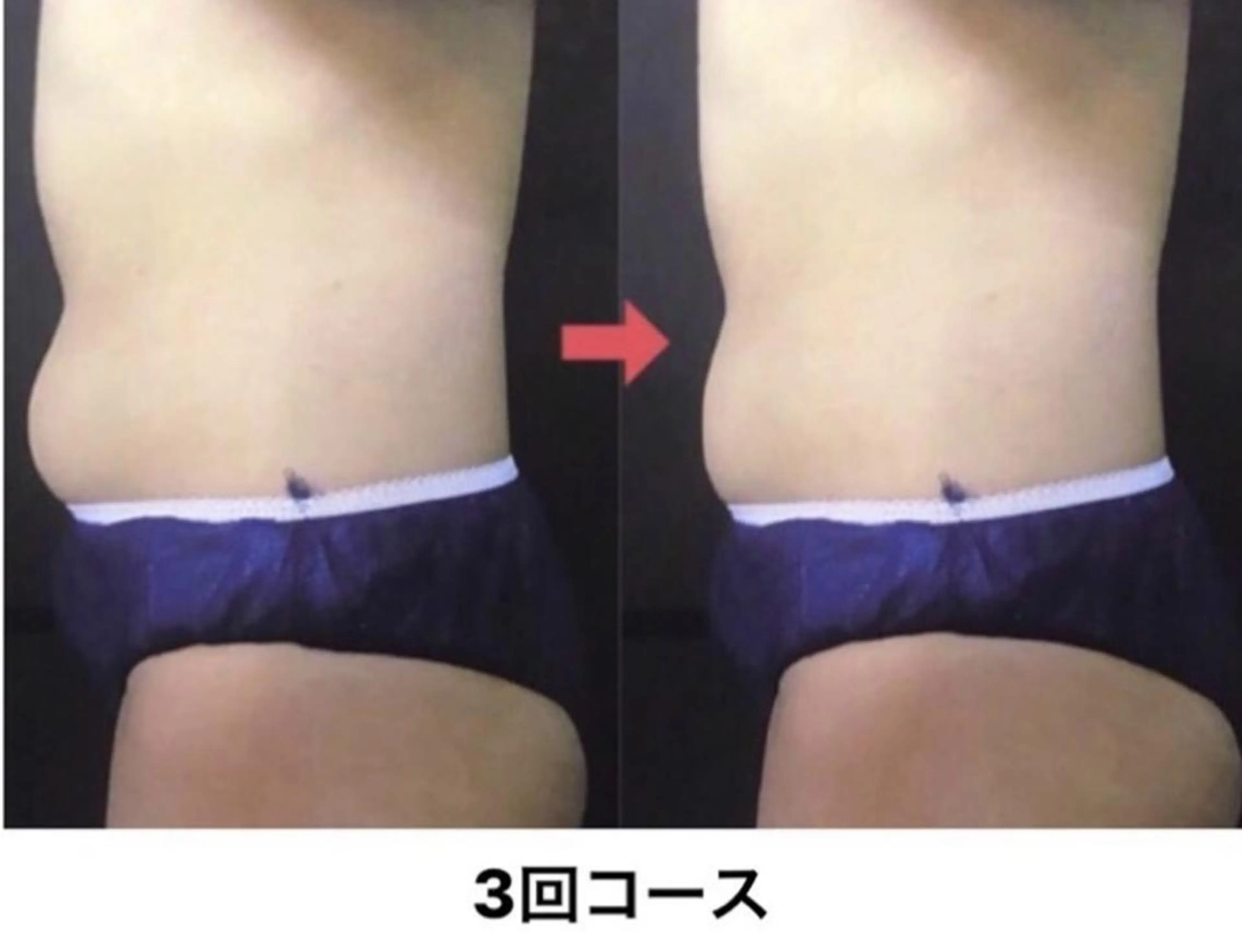 横浜エステサロン R-ing　リングのエステ・リラクイメージ