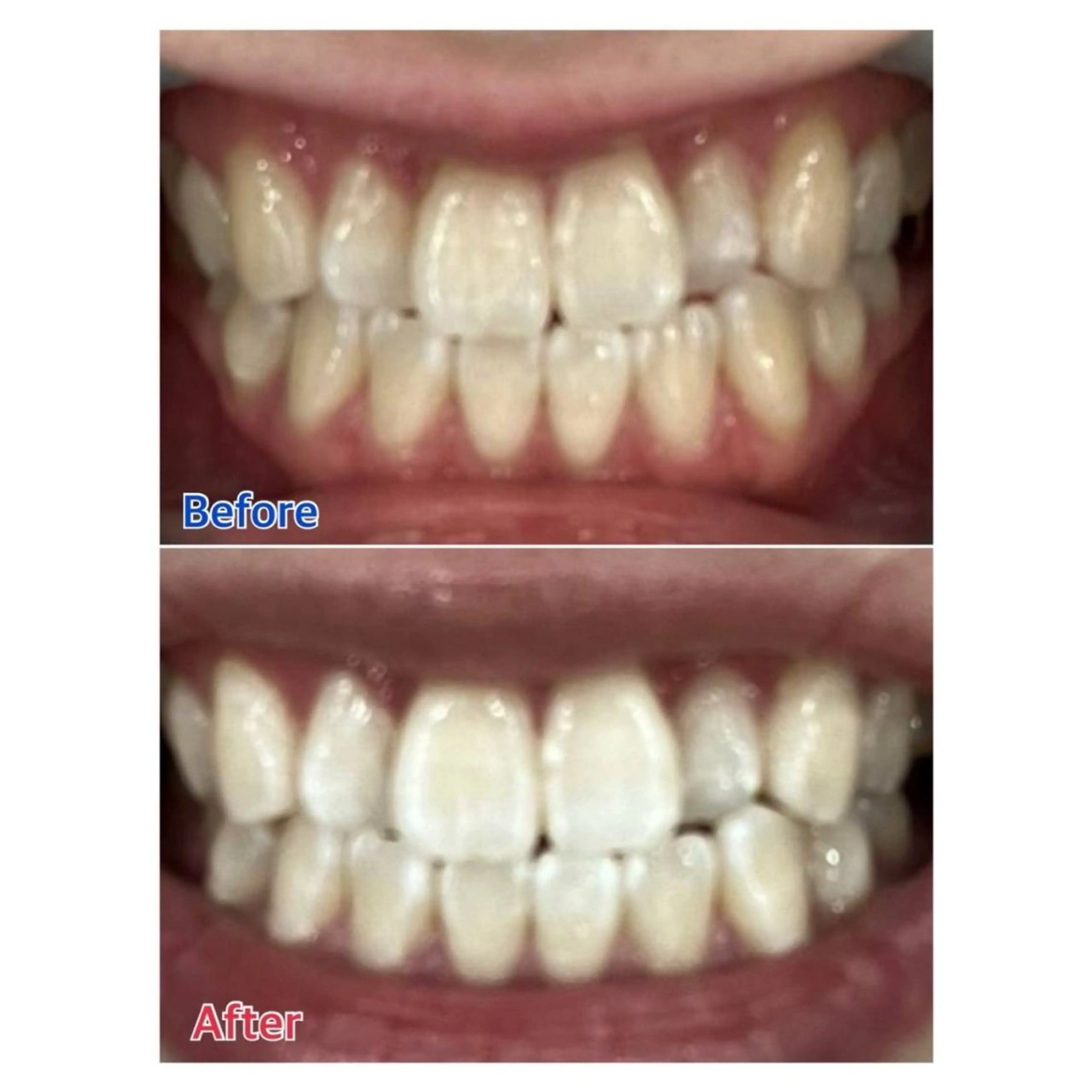 MBEAUTYSALON 千葉店・京成大久保所属・Melty 輝のその他イメージ