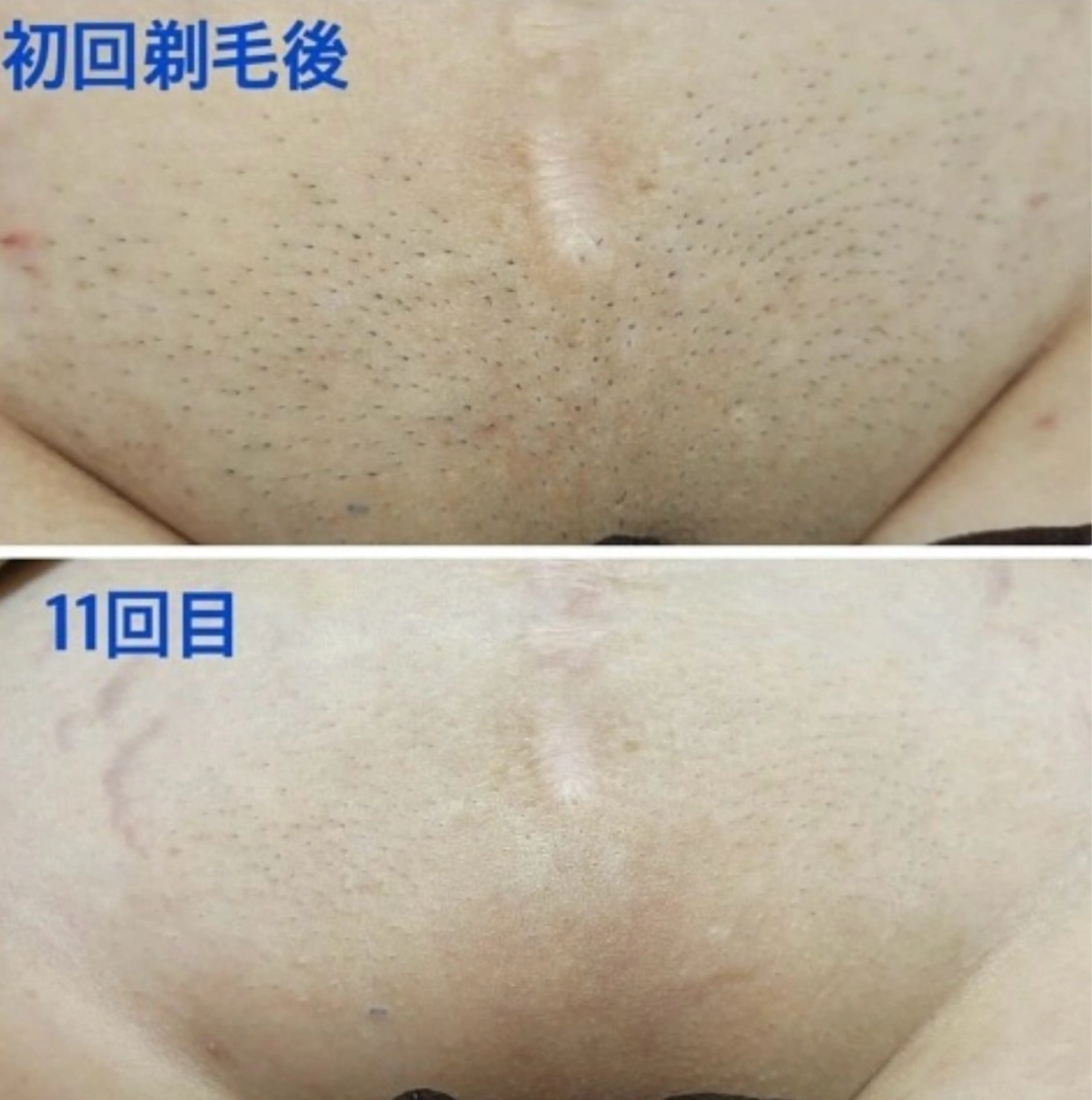 VANILLA SKY所属・VANILLA SKYのエステ・リラクイメージ