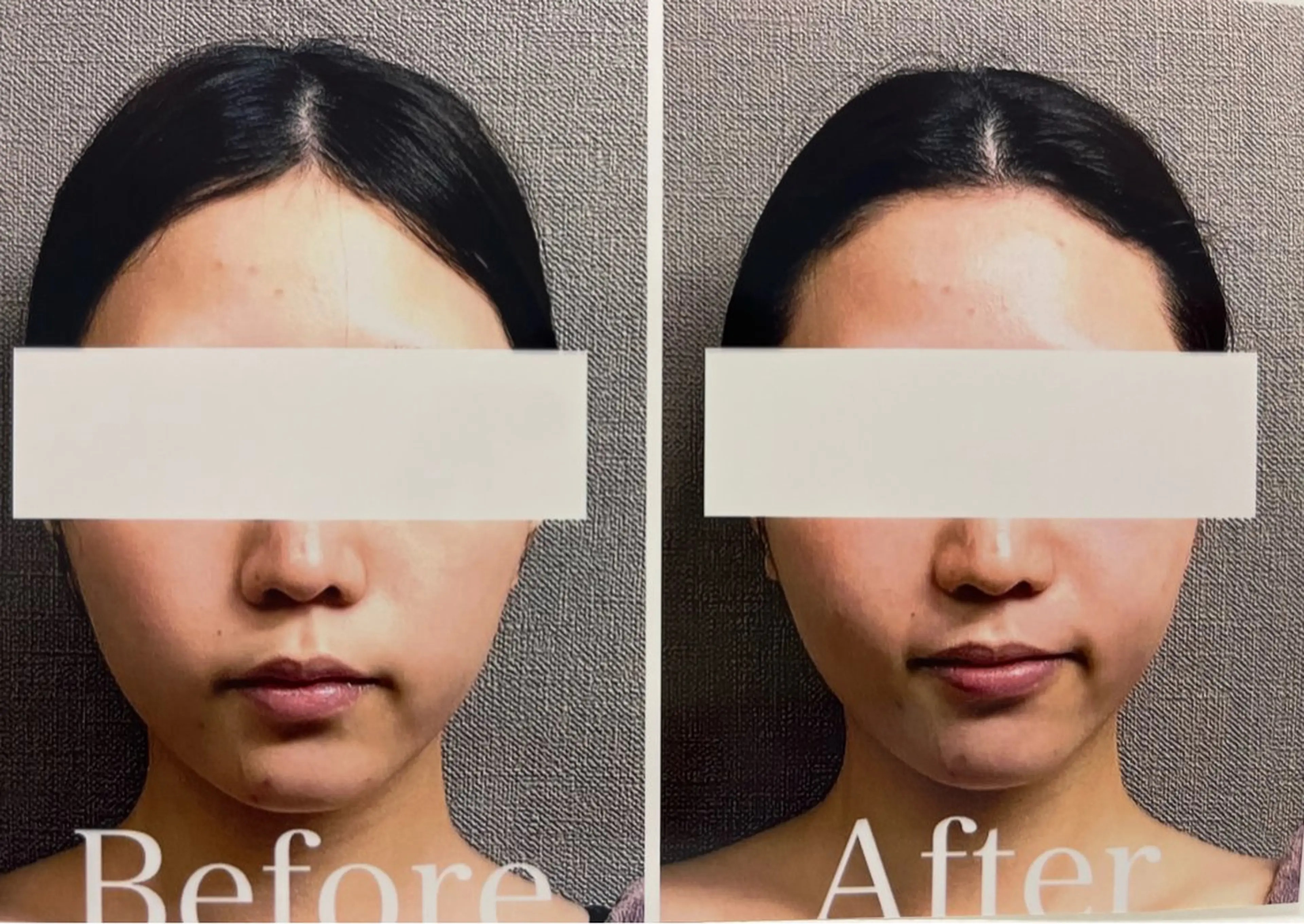 MIRAI小顔 溝の口店のエステ・リラクイメージ