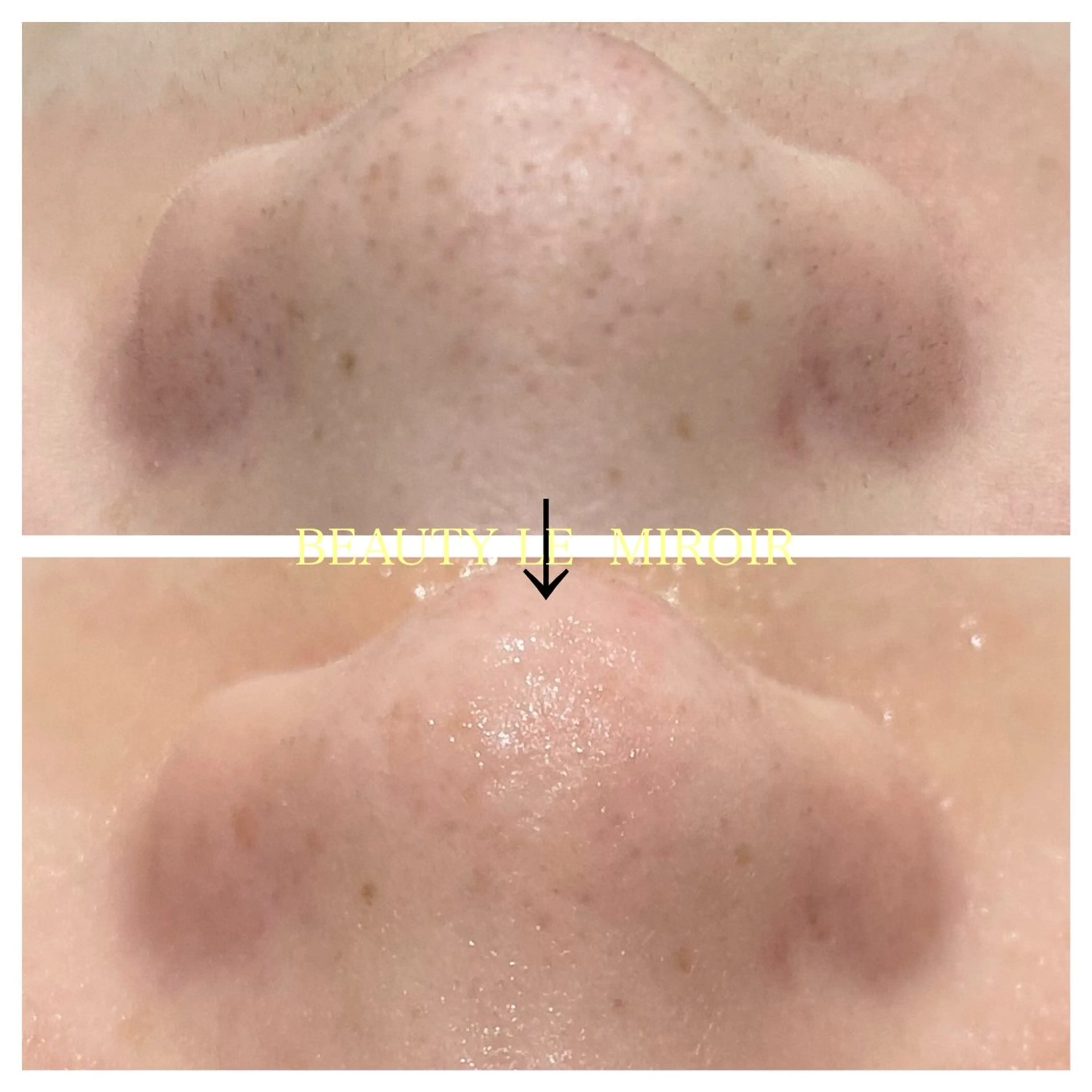 エステ ビューティー ミロワールのエステ・リラクイメージ