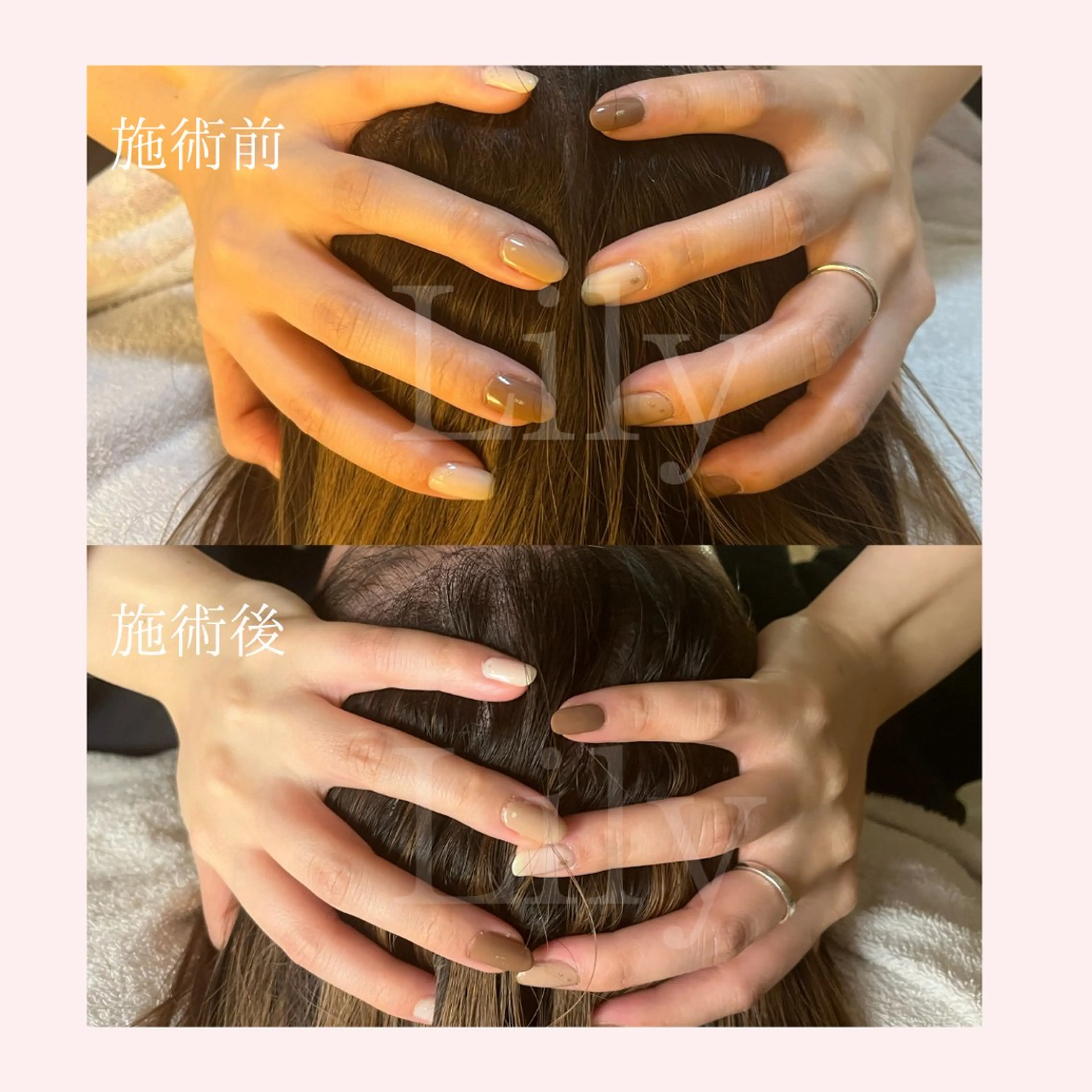 トータルビューティー サロンLilyのエステ・リラクイメージ