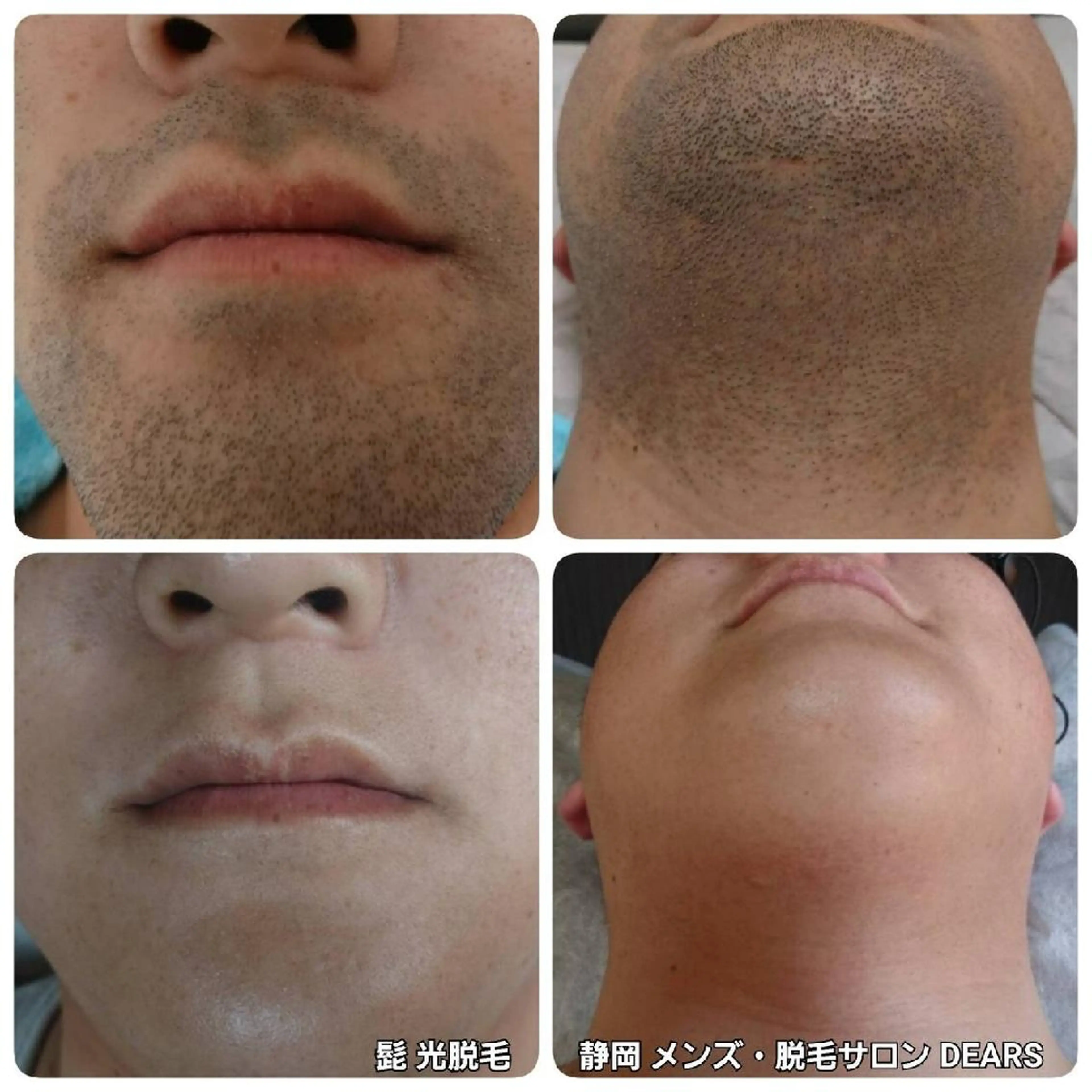 メンズ メンズ・脱毛サロン DEARS所属・山村幸久　メンズ脱毛 ディアーズのエステ・リラクイメージ