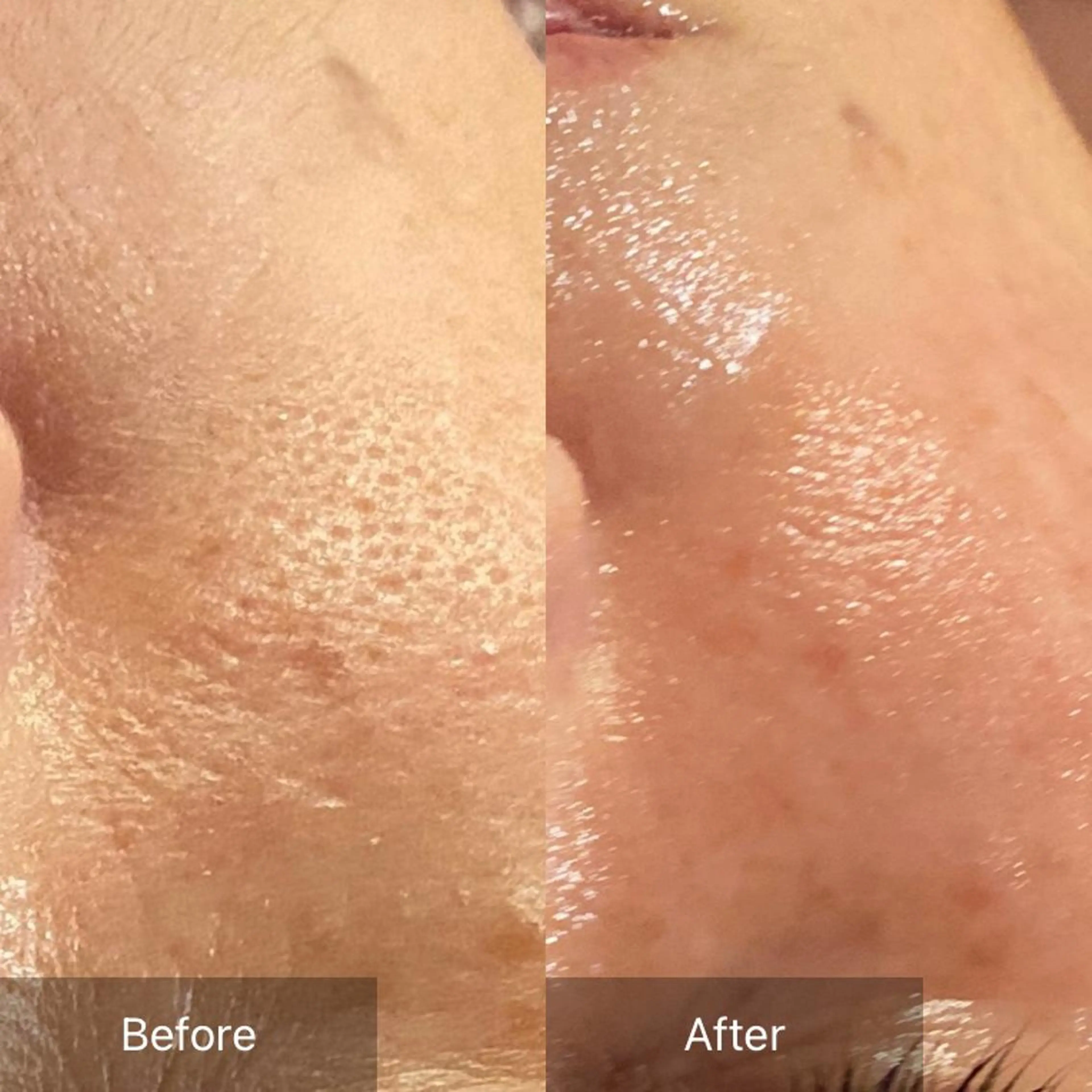 毛穴から始める肌メン テマンダリンオレンジのエステ・リラクイメージ