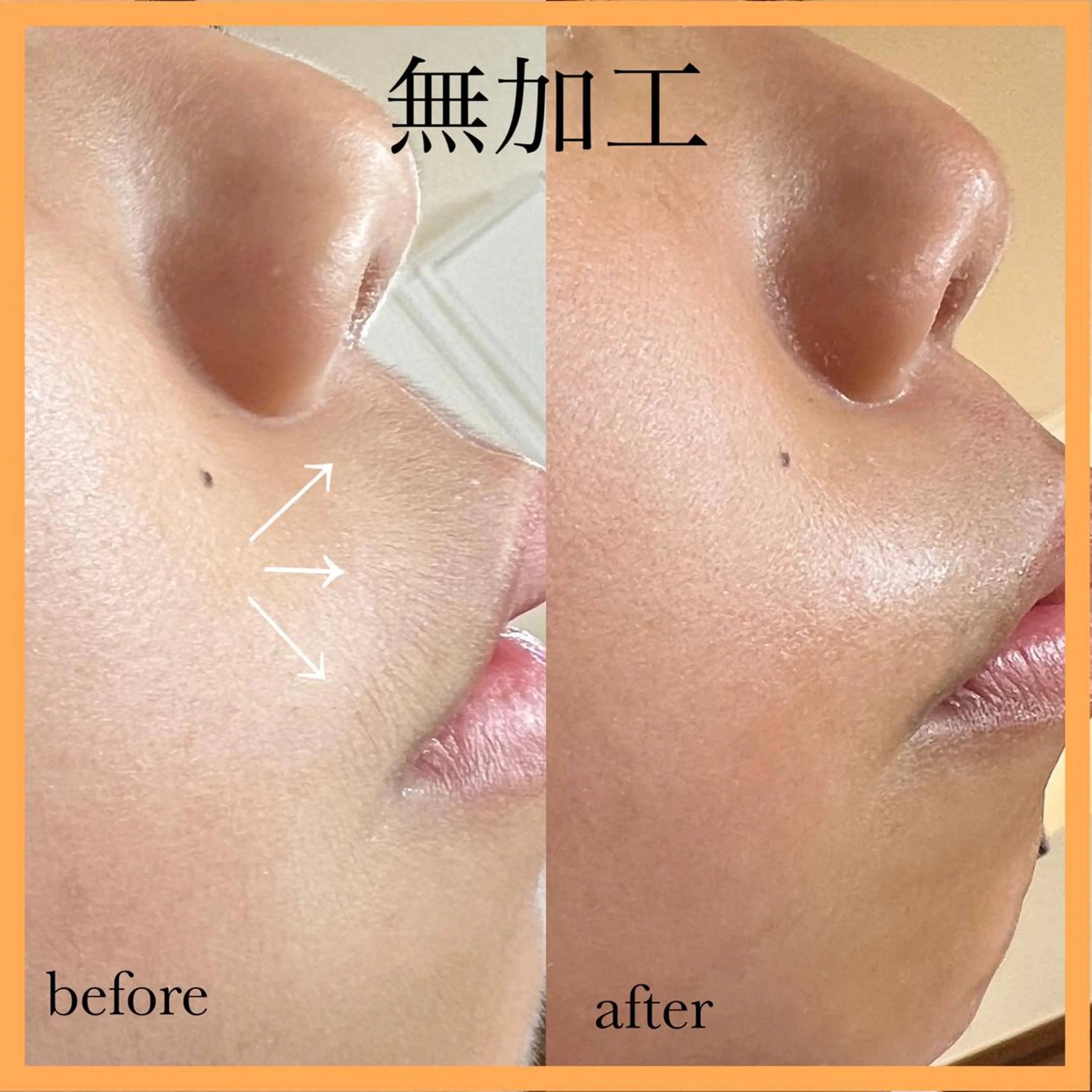 脱毛 Pua Meliaのマツエク・マツパデザイン