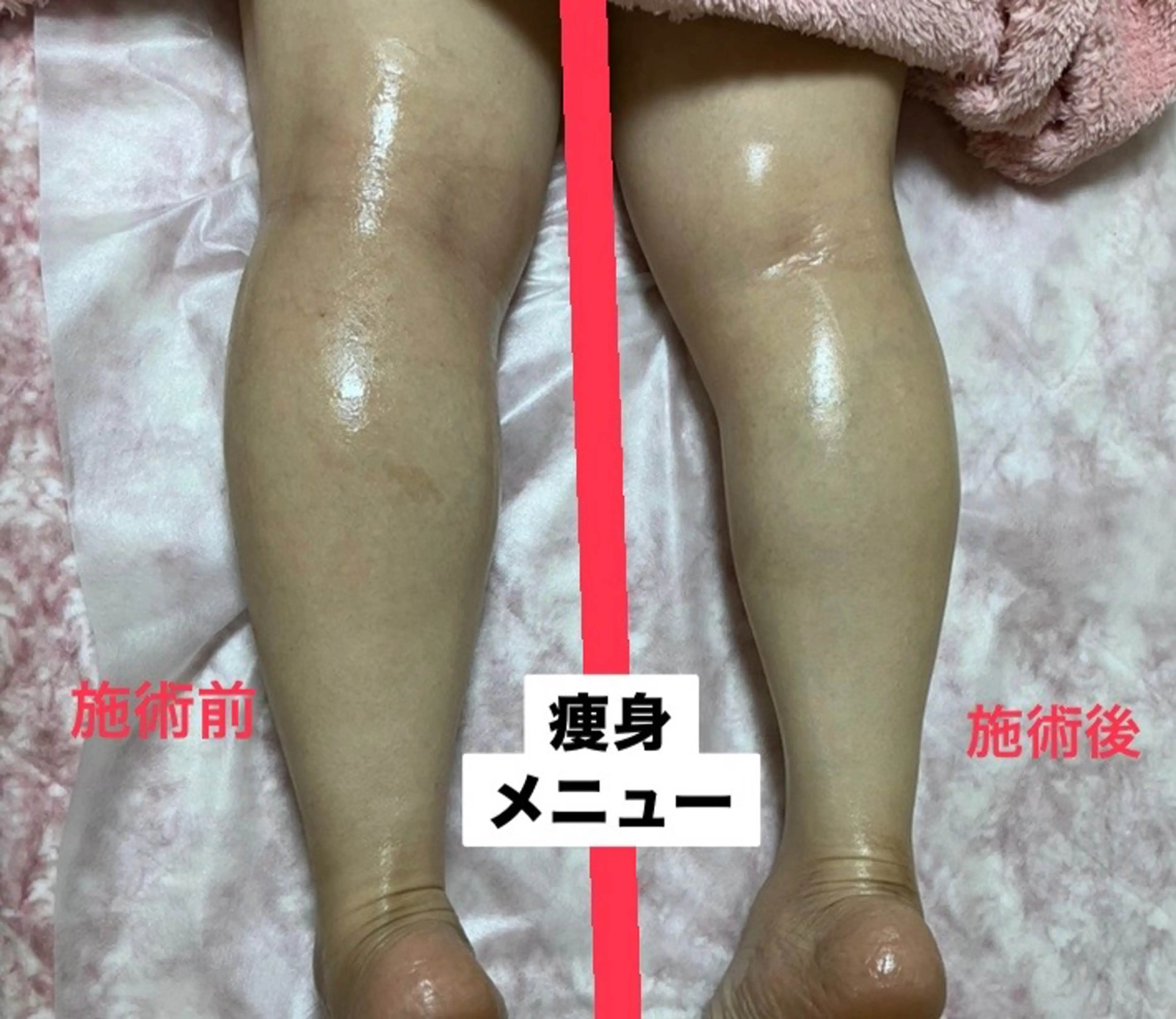 エステ akua... 【肌質管理専門】のその他イメージ