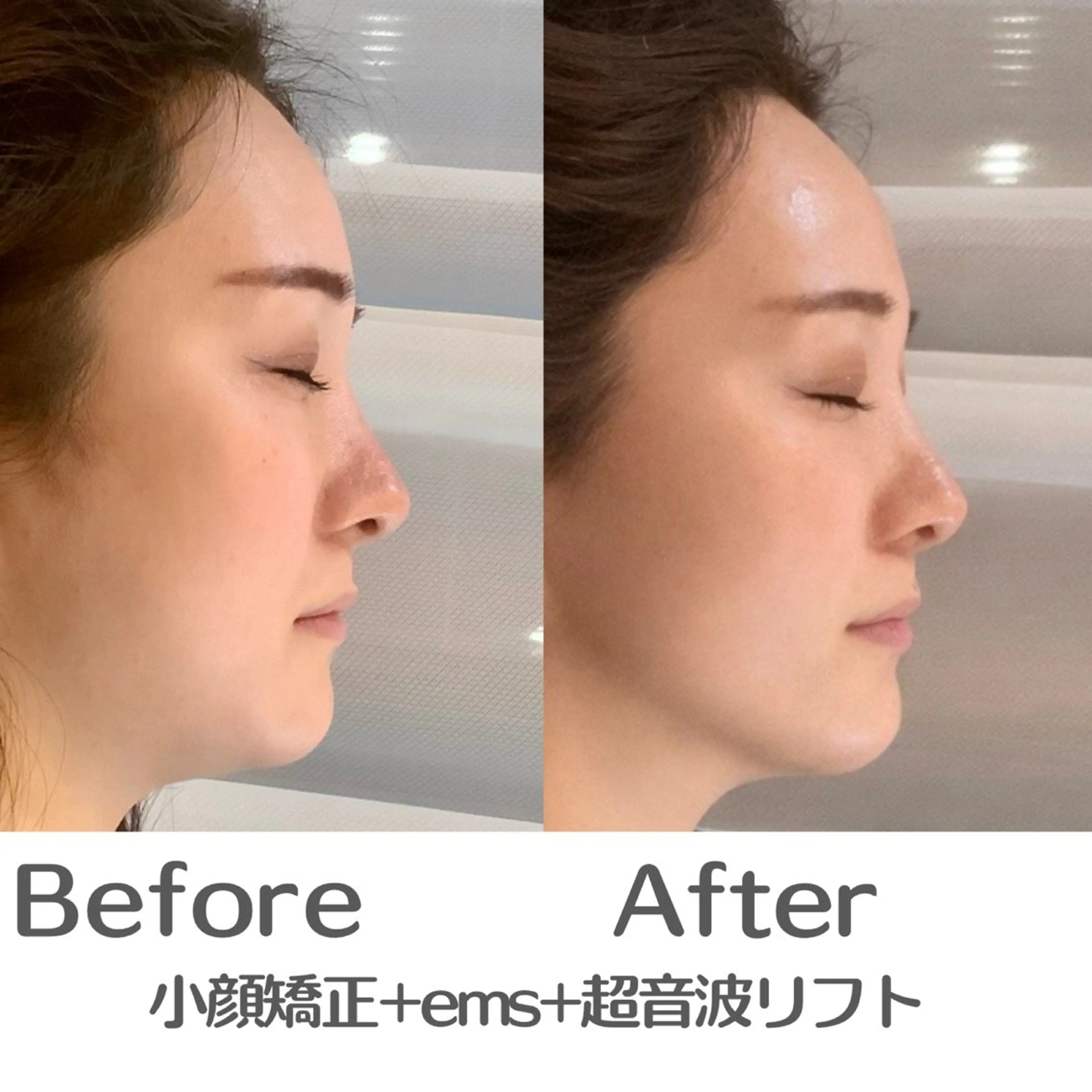 最速小顔・肌質管理 espoirマキのエステ・リラクイメージ