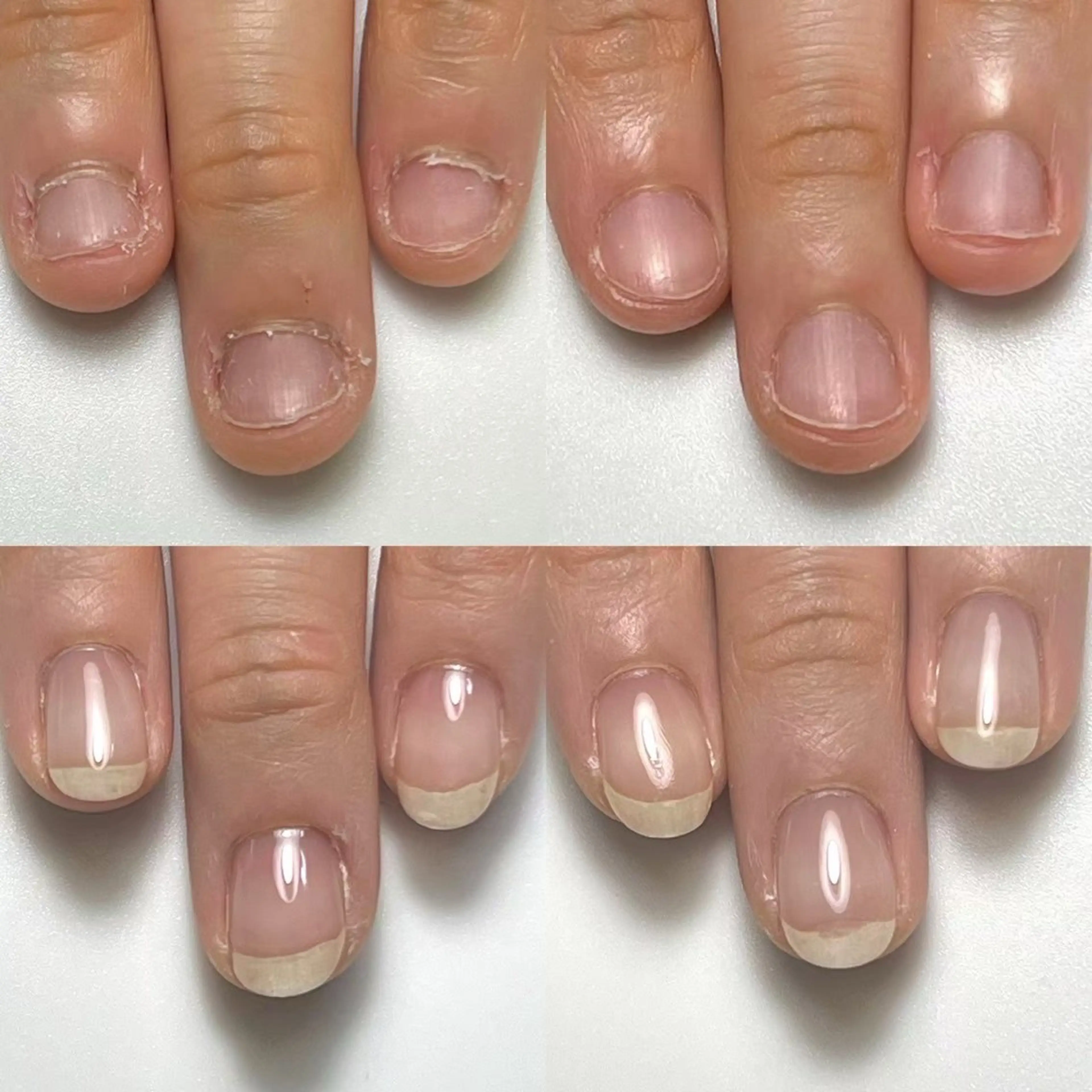 自爪育成ネイルの写真