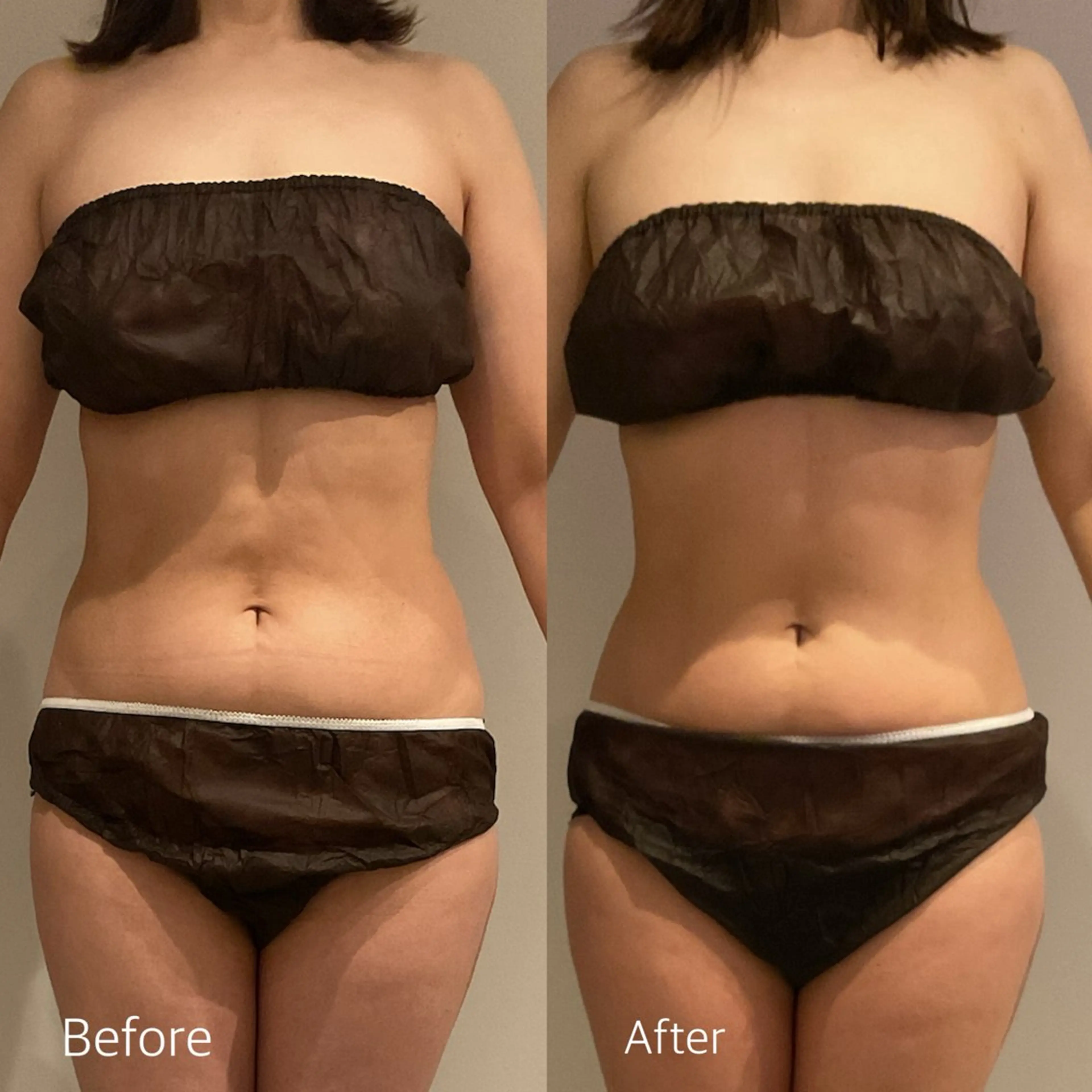 Esthetic MiEUXのエステ・リラクイメージ