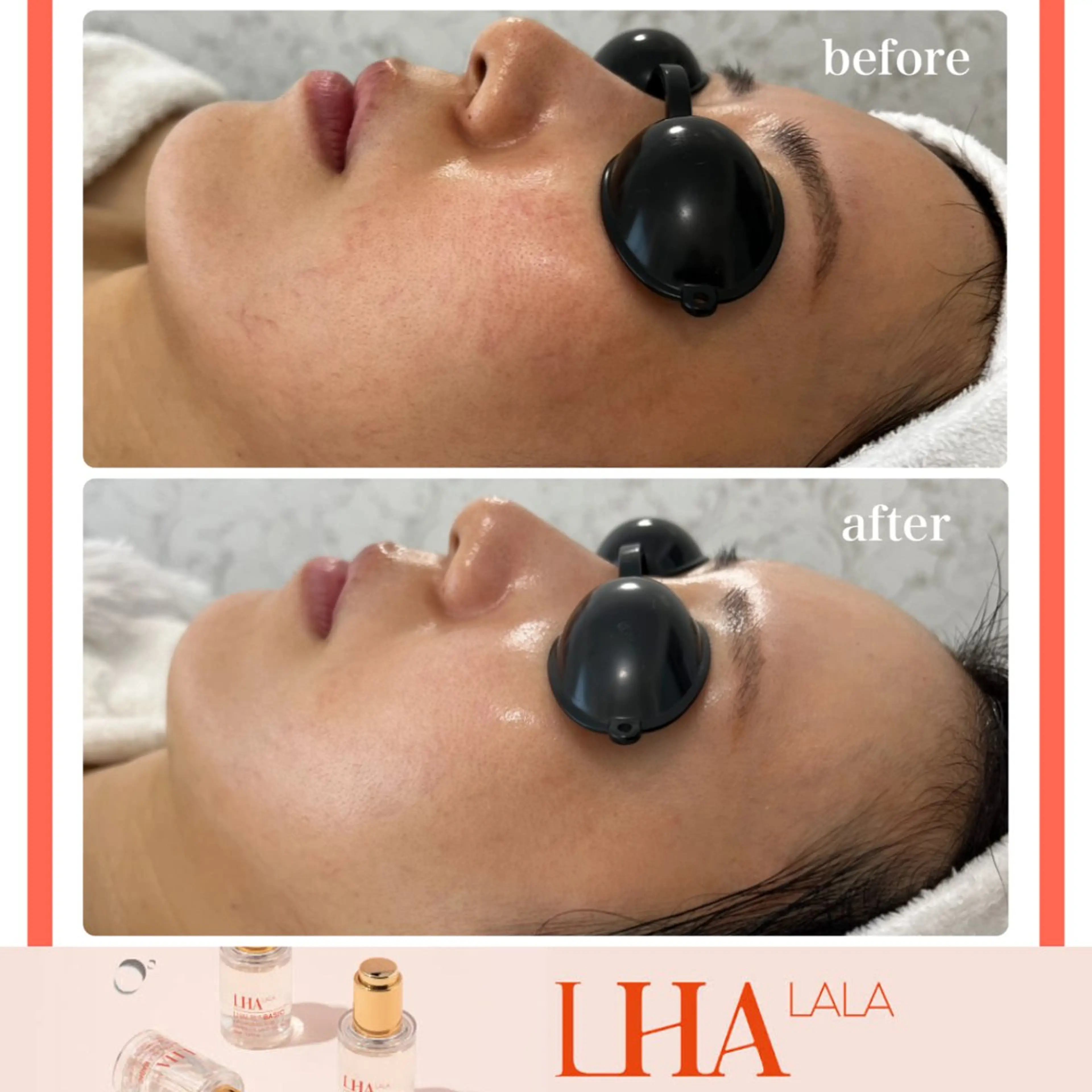 LiAm《美肌管理/ 小顔/脂肪ケア》のその他イメージ