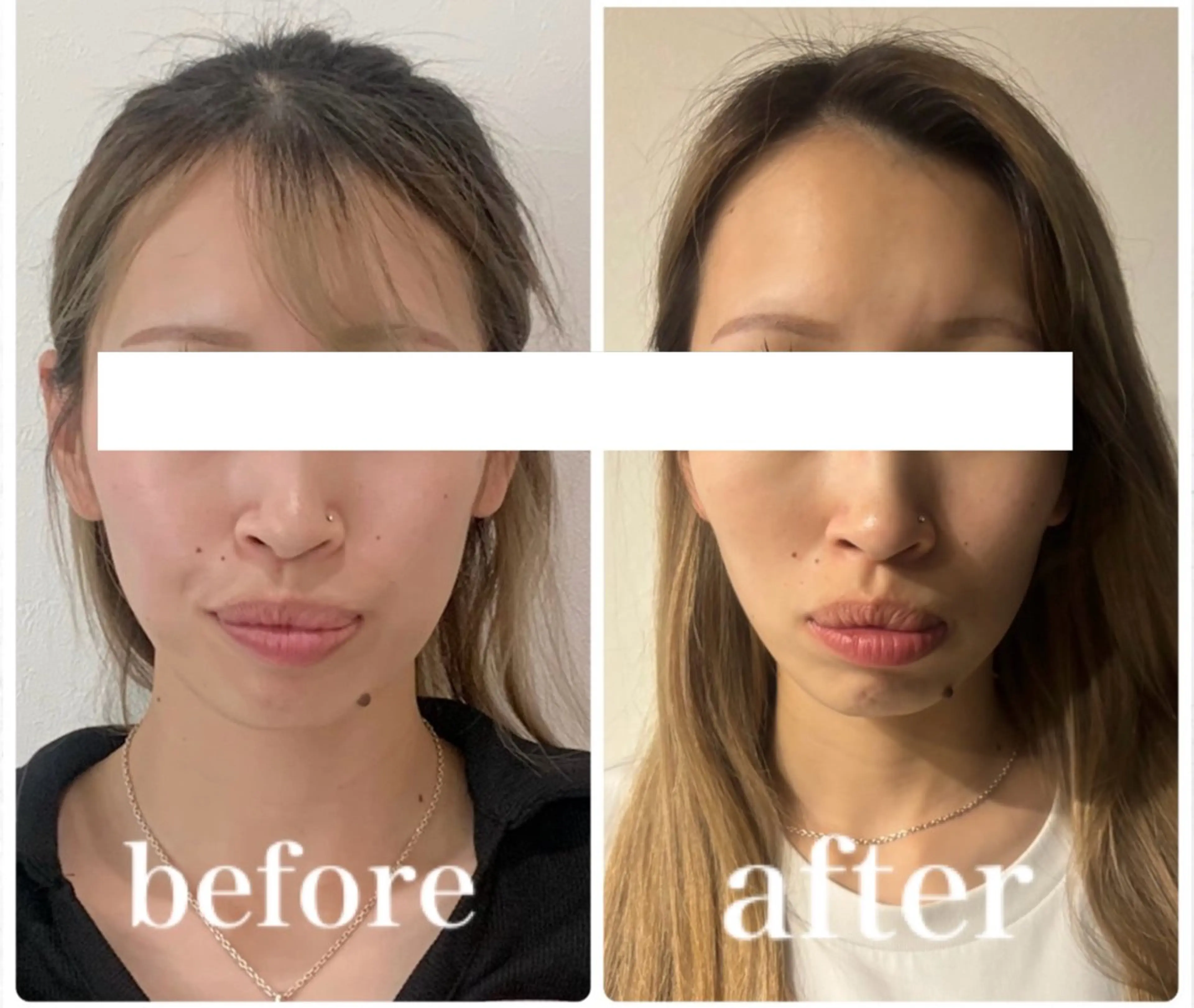 エステ リラク 小顔と ヘッドスパのお店のエステ・リラクイメージ