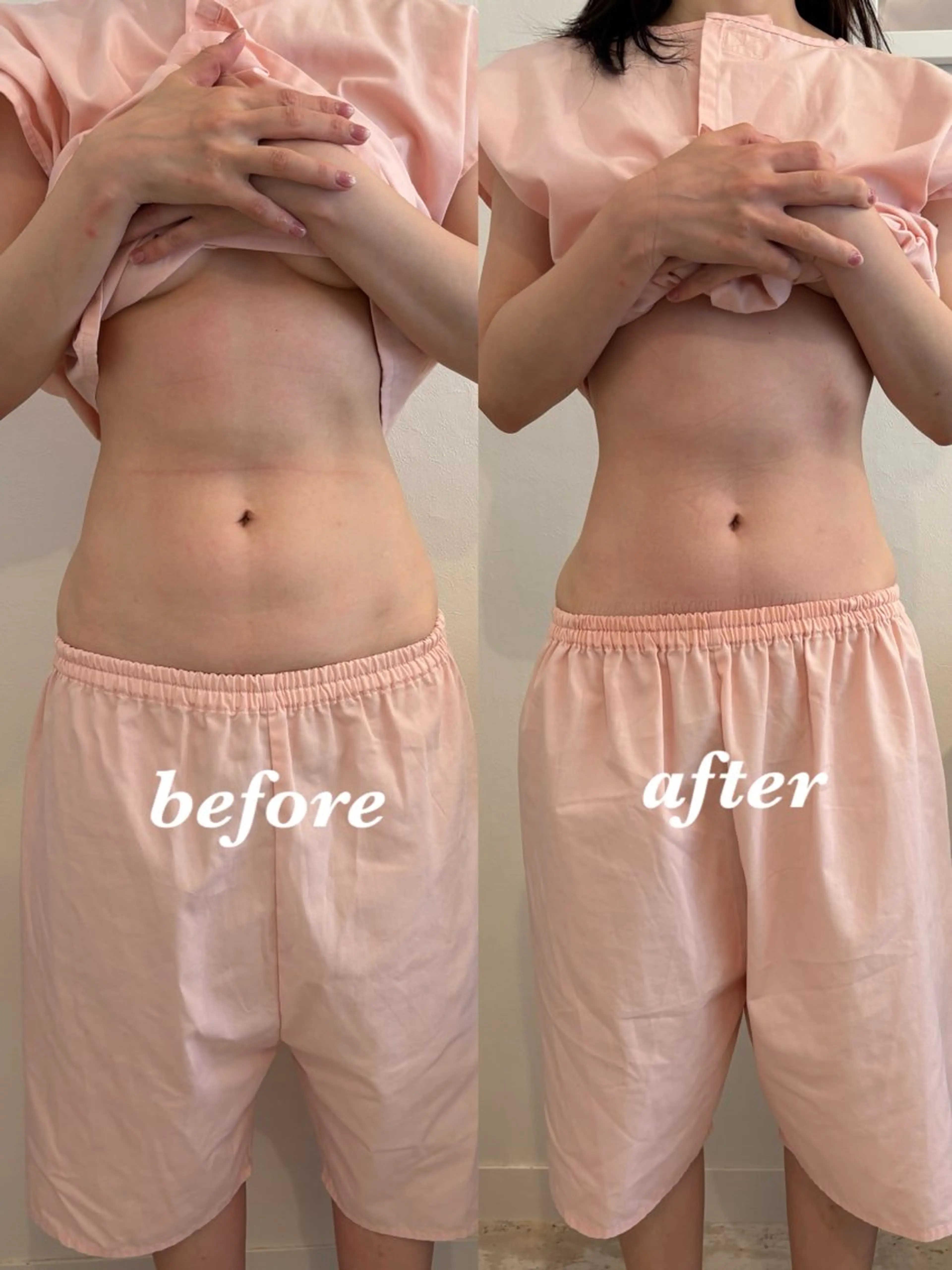 エステ リラク 腸活サポート みなみののエステ・リラクイメージ