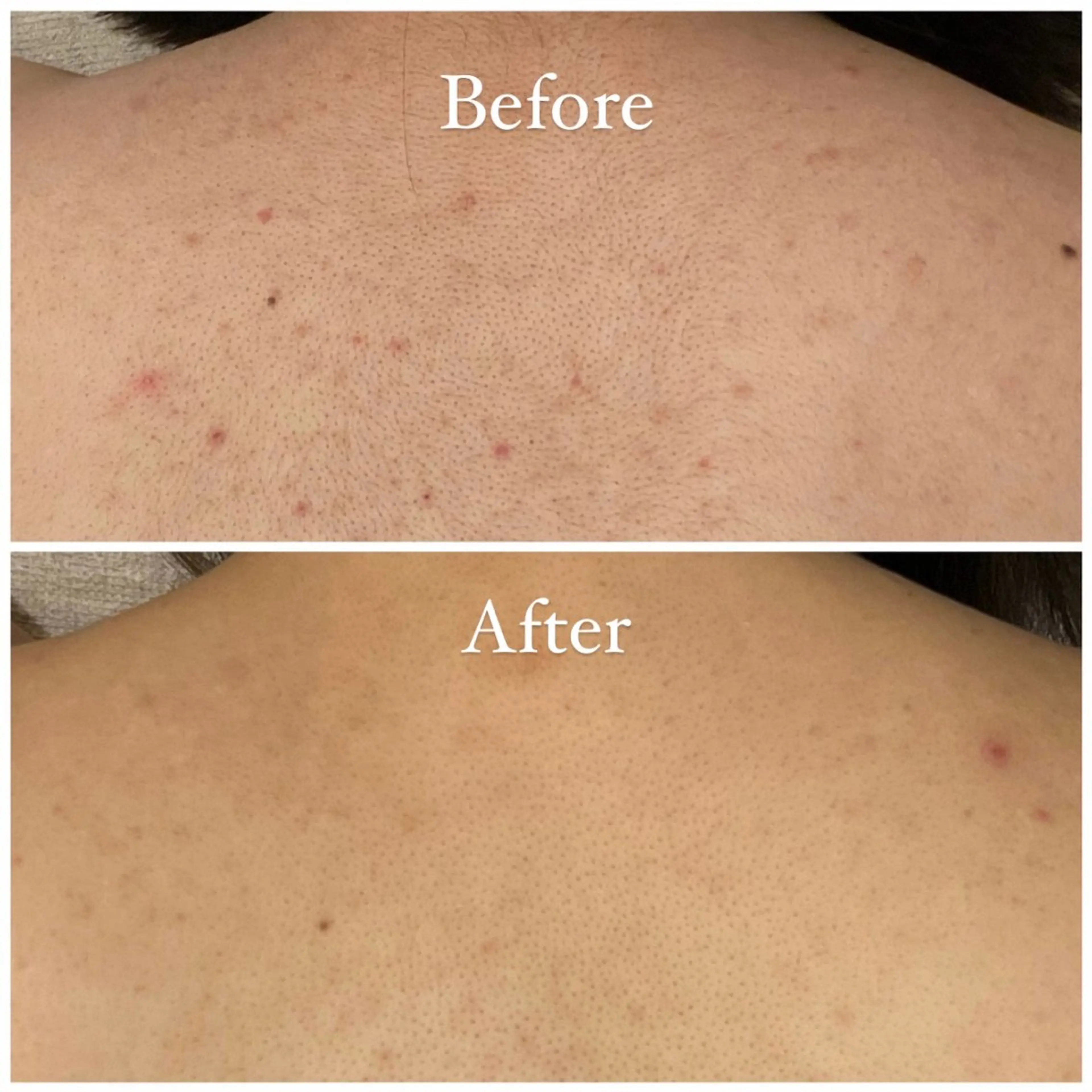 脱毛 Tulipe Chihoのエステ・リラクイメージ